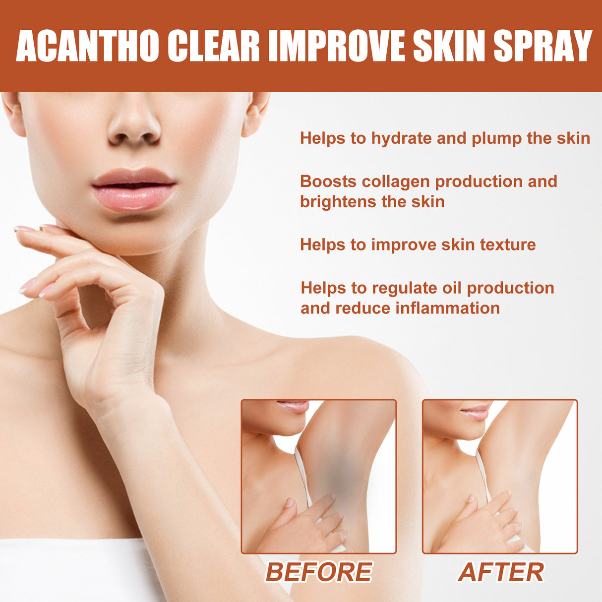 Acantho Clear Improve Skin Spray, Repair Black Spot, Elbow Knee Joint Black Whitening Skin Spray - V.I.P Digital Presence