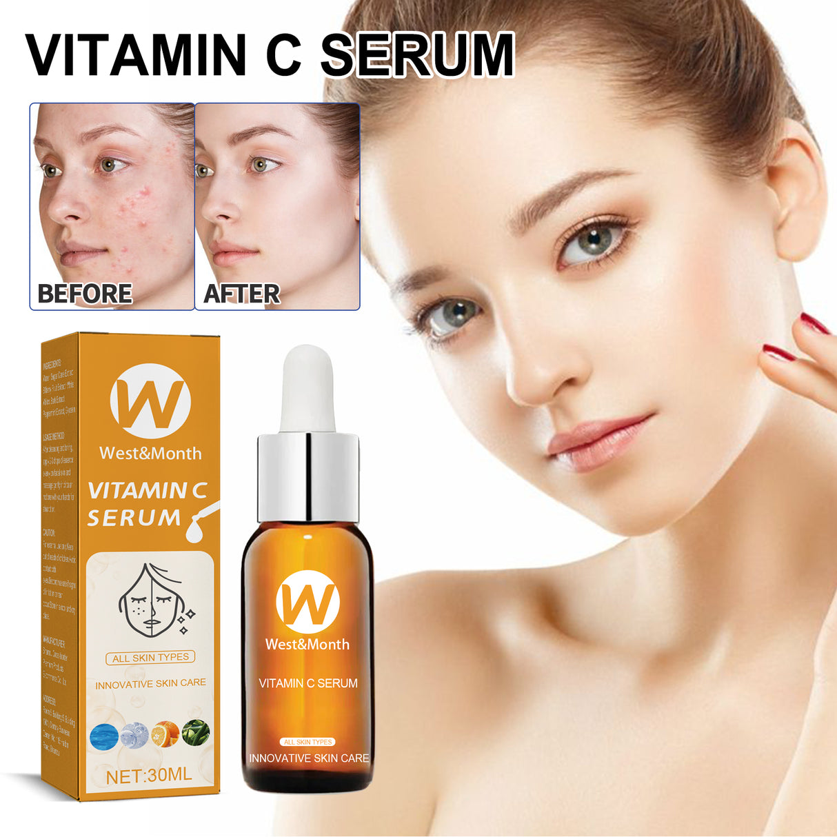 Facial Treatment Essence, Lighten Facial Acne Mark Oil Control Firming Skin Essence - V.I.P Digital Presence