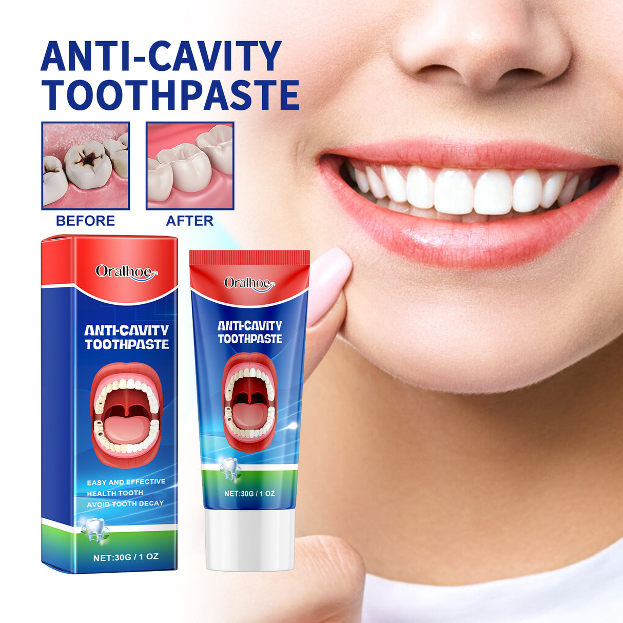 Anti-Cavity Toothpaste, Oral Cleaning Dental Yellow Caries Dental Care Gingival Reinforcement Dental Care Fresh Breath - V.I.P Digital Presence