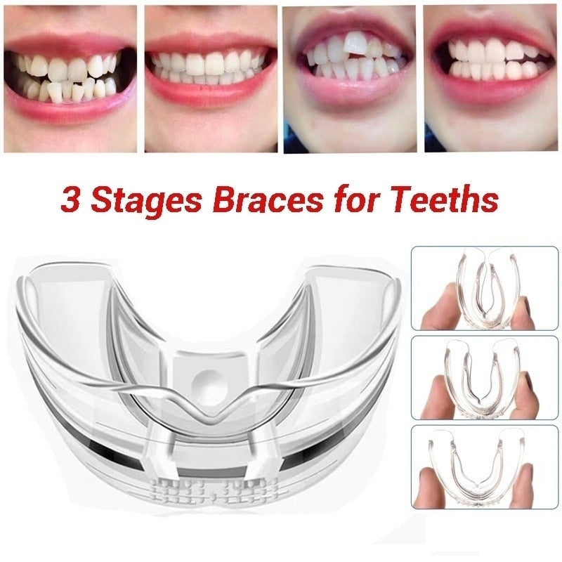 3 Stages Dental Orthodontic Braces Appliance Braces Alignment Trainer Teeth Retainer Bruxism Mouth Guard Teeth Straightener - V.I.P Digital Presence