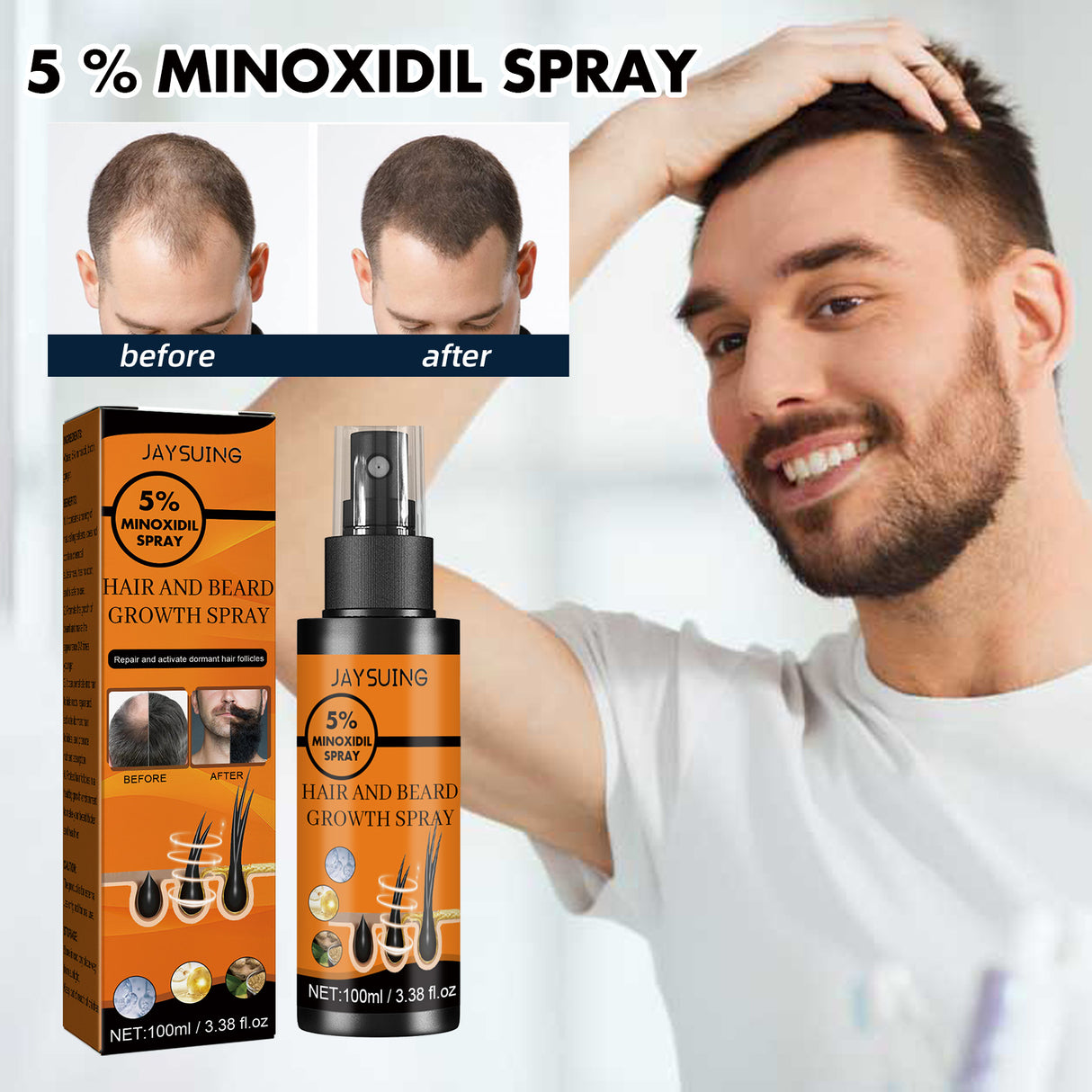 Hair Growth Spray, Men Hair And Beard Thickening Strengthening Anti-loss Care Solution - V.I.P Digital Presence