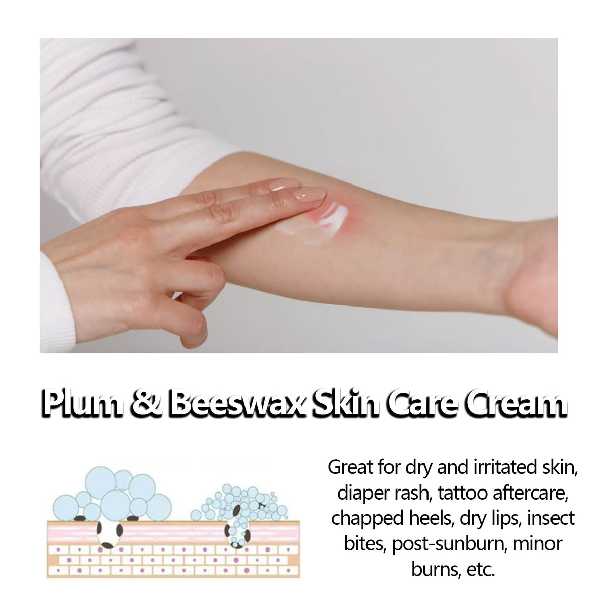 Beeswax Skin Cream Moisturizes Skin, Relieves Dry Skin, Sunburn, Mosquito Bites And Itch Relief Cream - V.I.P Digital Presence