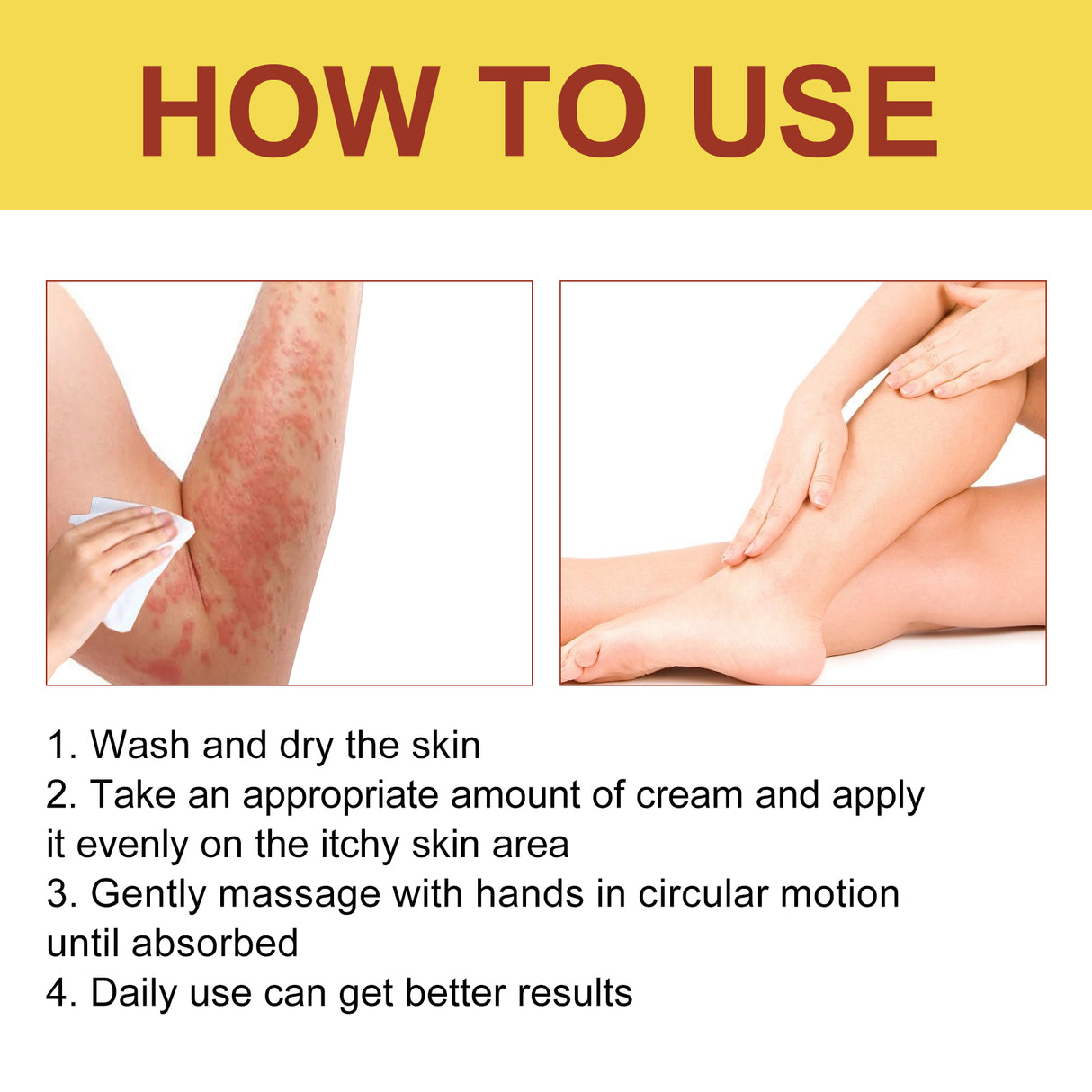 Breaking Itch King, Relieve Hand And Foot Moss Skin Moss Redness Repair Skin Itching Skin Care Cream - V.I.P Digital Presence