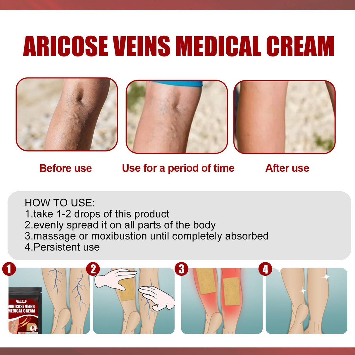 Aricose Veins Medical Cream, Relieve Leg Swelling Earthworm Leg Vein Massage To Relieve Pain - V.I.P Digital Presence