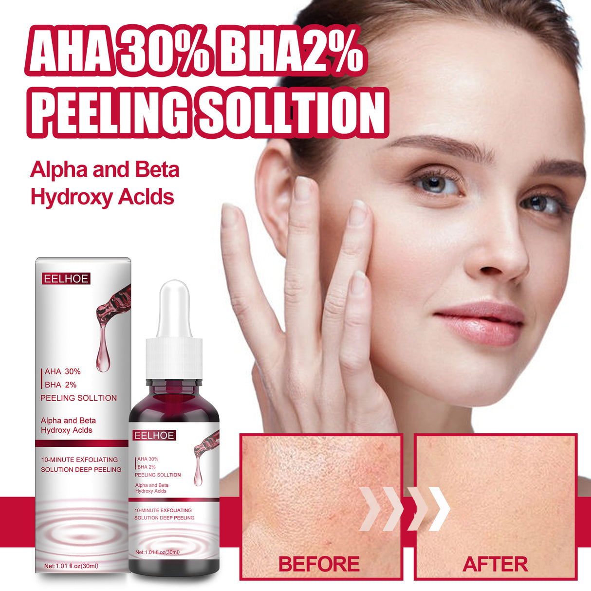 AHA30% + BHA 2% Fruit Acid Salicylic Acid Essence, Exfoliating Cleaning Blackheads Acne And Shrinking Pores Essence - V.I.P Digital Presence