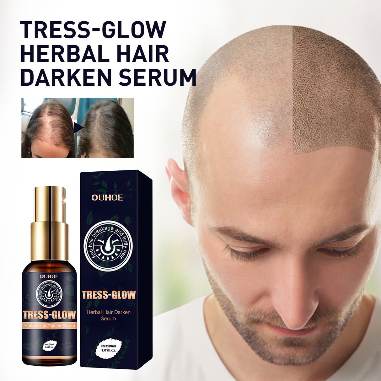 Herbal Hair Essence, Moisturizes Scalp Strong Hair Roots Thick Beard Care Essence - V.I.P Digital Presence