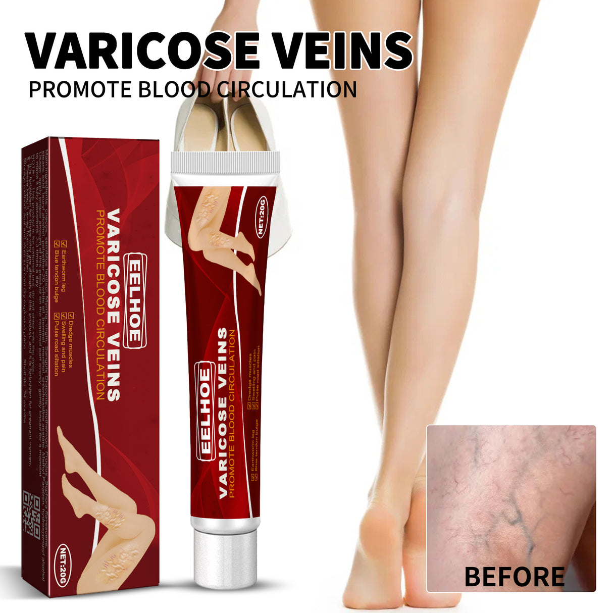 Venous Massage Varicose Cream, Relieves Bulging Leg Blood Vessels And Swollen Leg Earthworm Venous Massage Cream - V.I.P Digital Presence