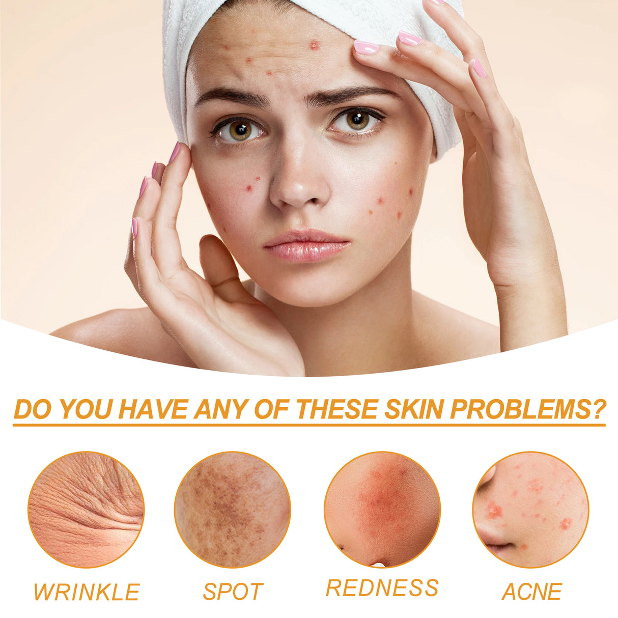 Facial Treatment Essence, Lighten Facial Acne Mark Oil Control Firming Skin Essence - V.I.P Digital Presence