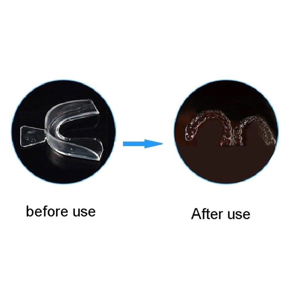 Dental materials teeth whitening tray, thermoplastic silicone tray, soft tray, whitening cold light tray - V.I.P Digital Presence