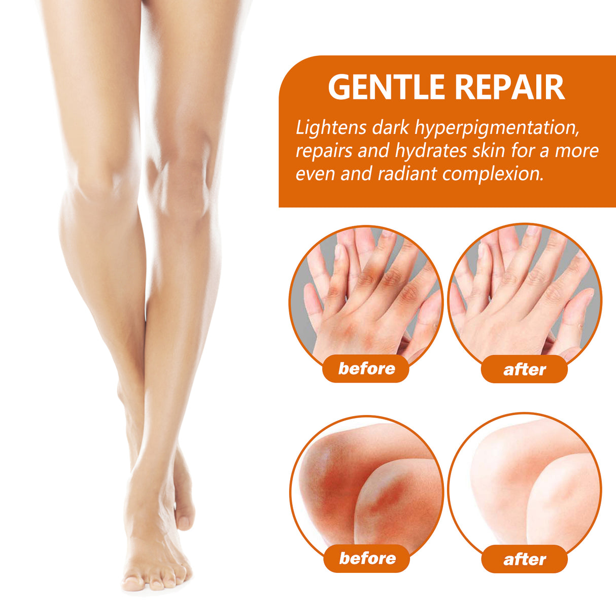 Acanthosis Nigricans Repair Essence, Brightening Skin Repair Skin Beauty Essence Underarm Joint Black Whitening - V.I.P Digital Presence