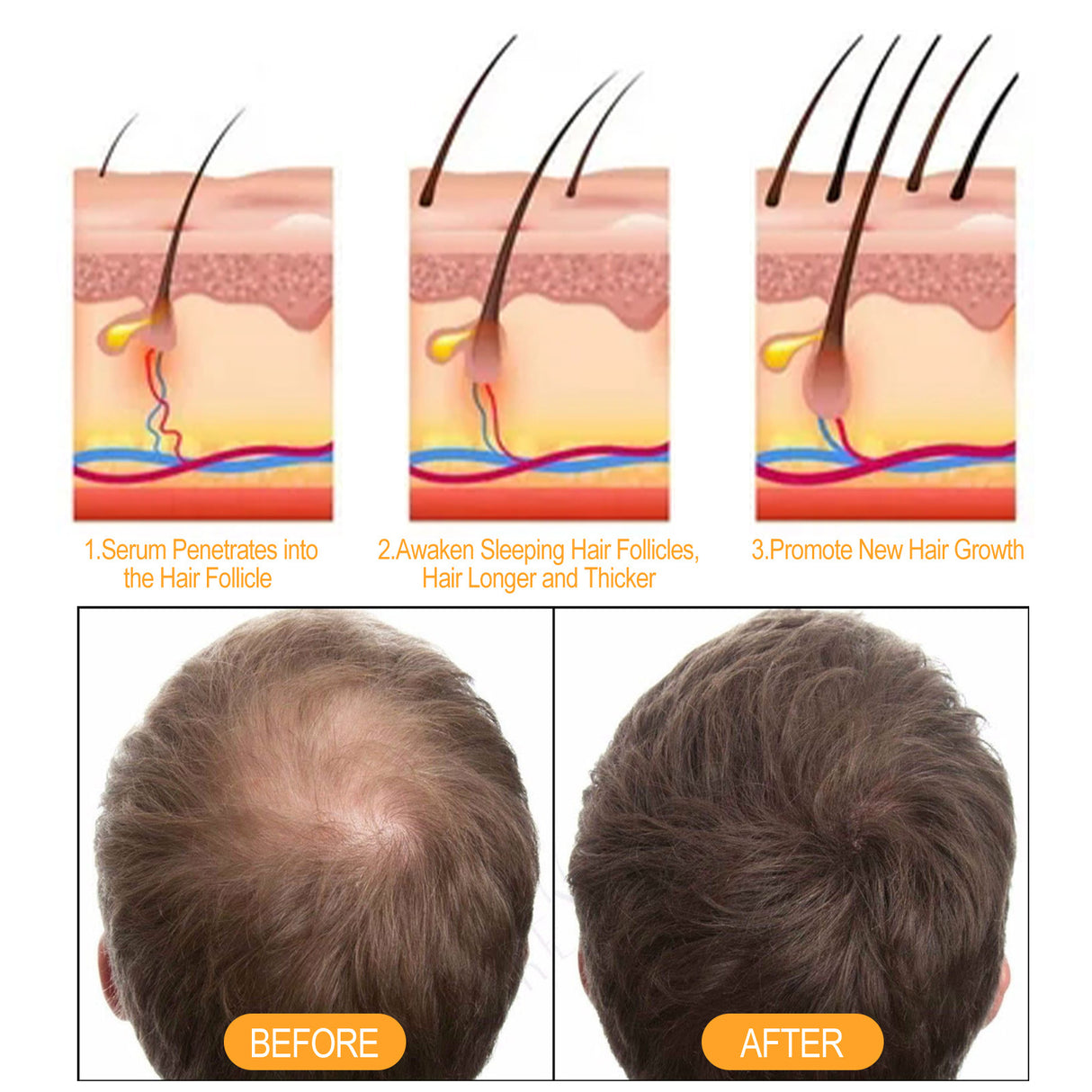 Ginger Juice Moisturizes Hair, Moisturizing And Repairing Hair Follicle Hair Strong Anti-Shampoos - V.I.P Digital Presence