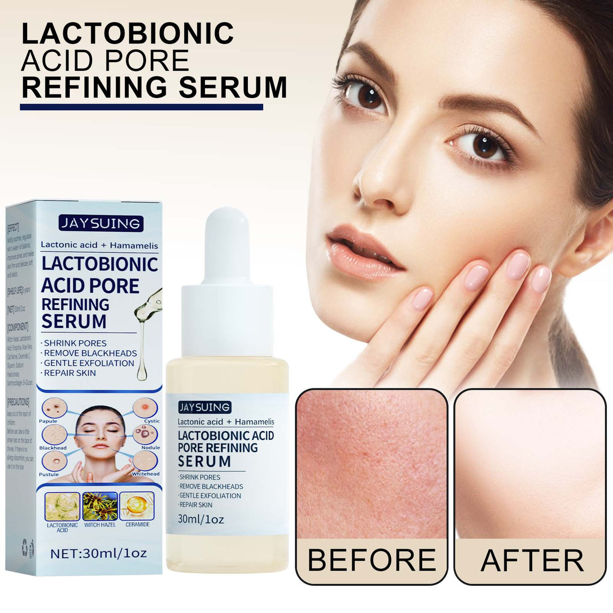 Lactose Solution, Exfoliate Remove Blackheads Shrink Pores Clean And Moisturize SkinEssence