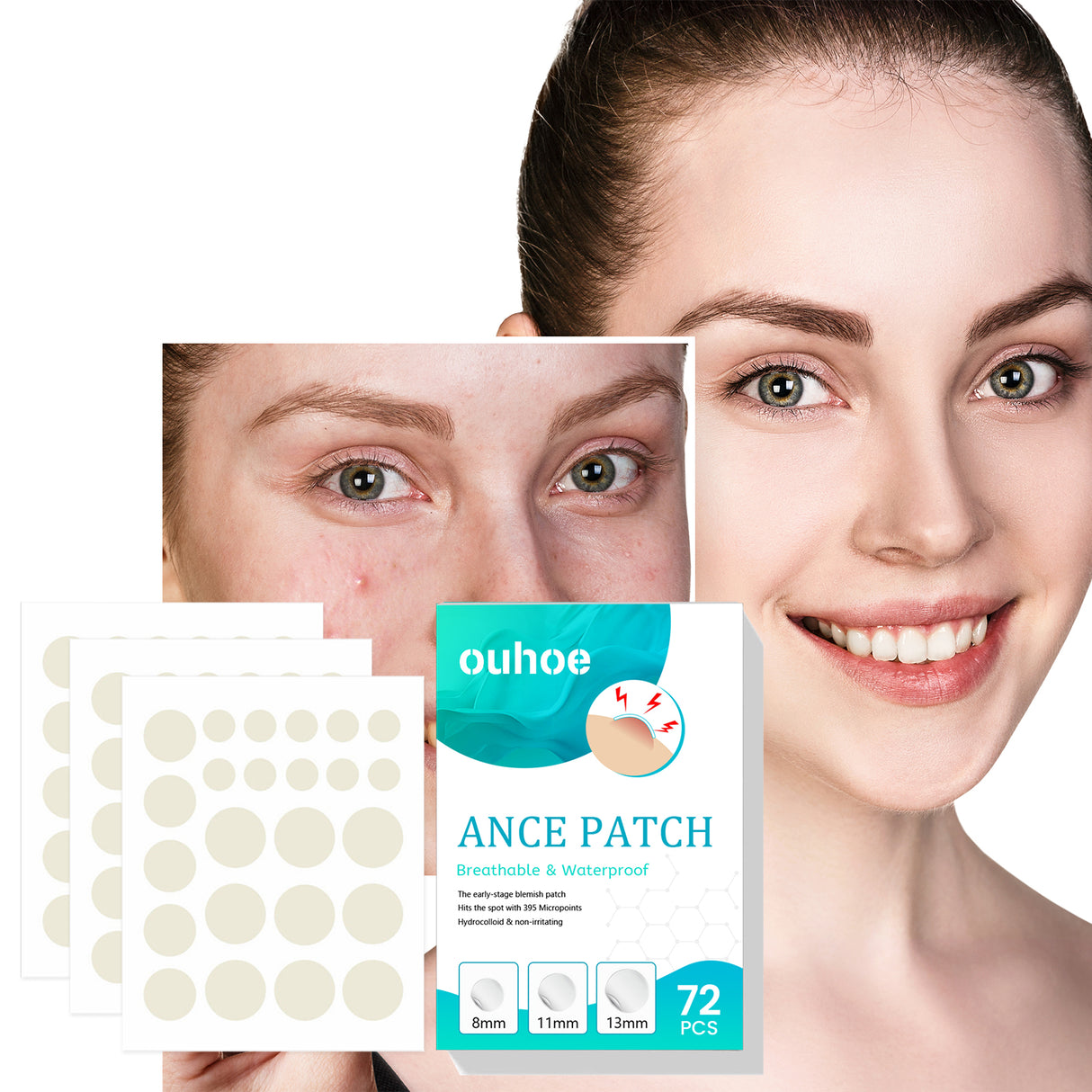 Acne Patch, Repair Facial Acne Invisible Concealer Hydrocolloid Patch - V.I.P Digital Presence