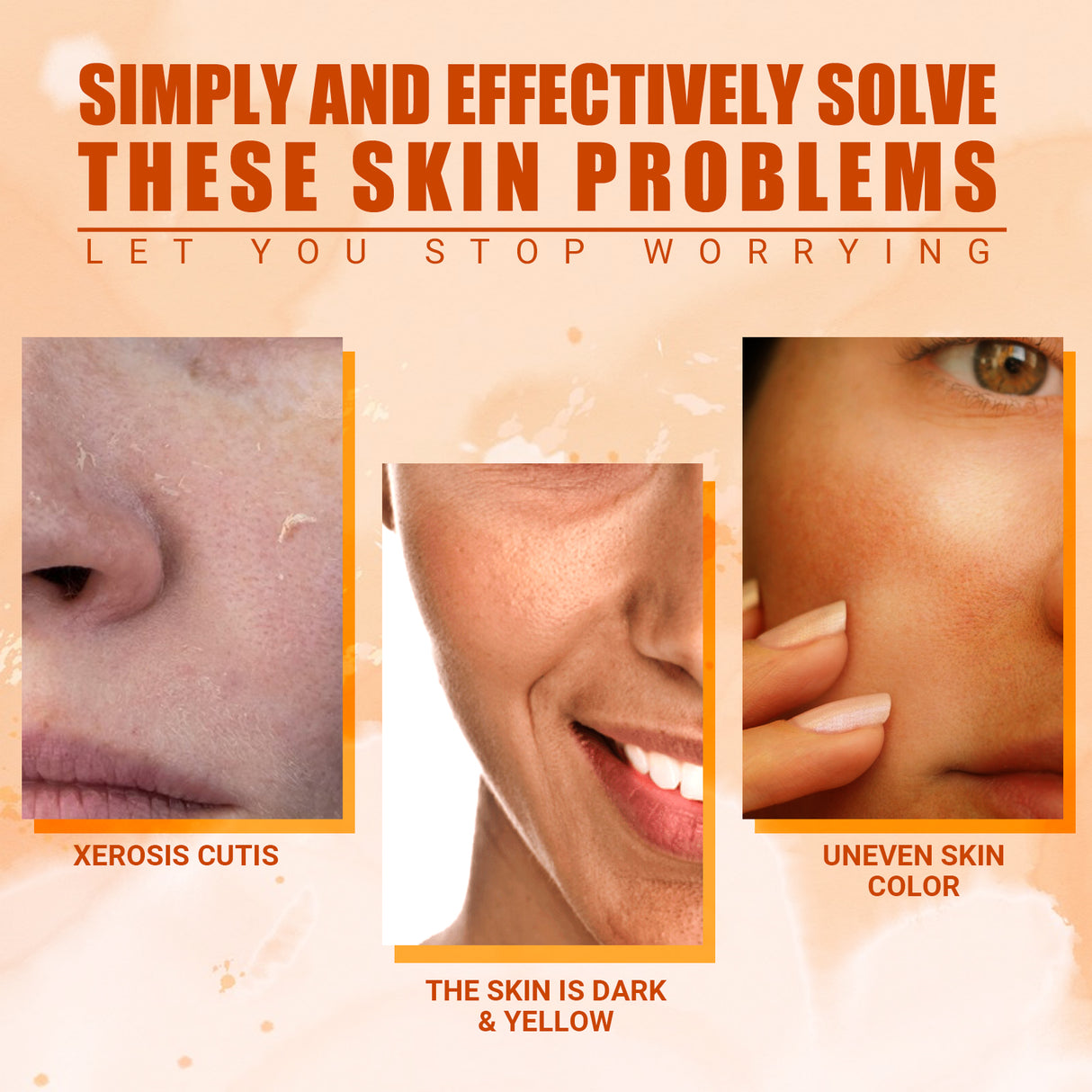 Vitamin C Moisturizing Spray Hydrates And Moisturizes Skin, Lightening Acne Spots And Whitening Spray - V.I.P Digital Presence