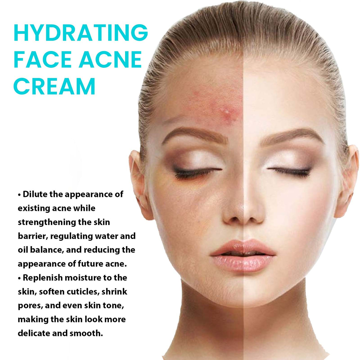 Brightening Anti-Acne Cream, Lighten Acne Pimples, Shrink Pores, Moisturize Skin Brightening Cream