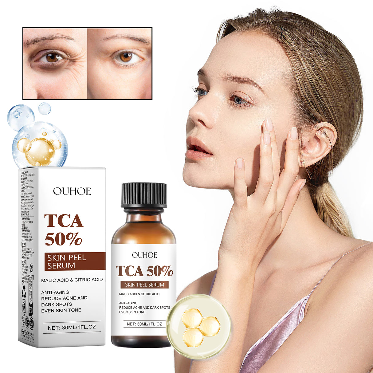 TCA 50 Skin Peel Serum, It Moisturizes Brightens The Firming Skin Fade Wrinkles This Skin Cream - V.I.P Digital Presence