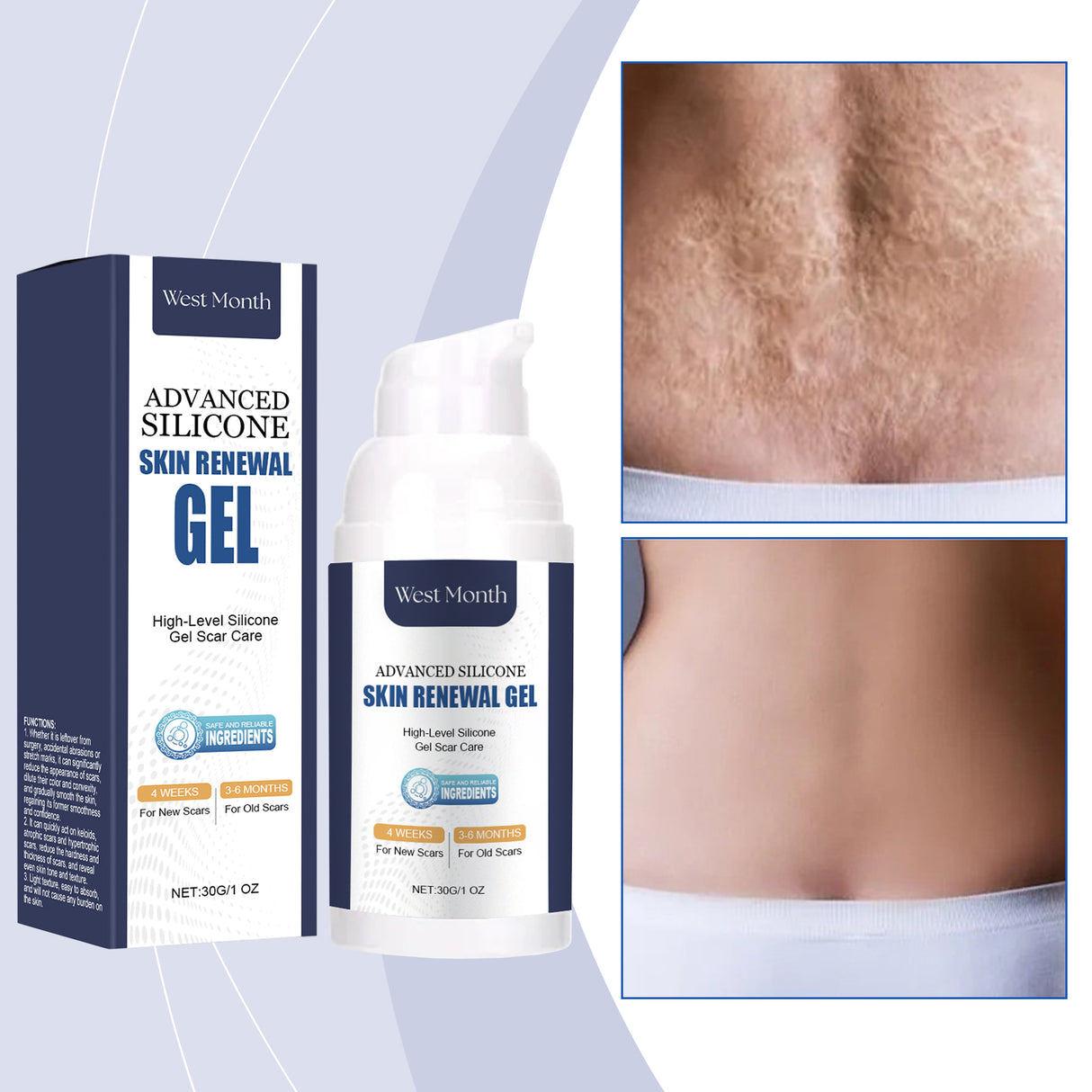 Skin Repair Gel, Gently Nourishes Body Skin And Naturally Shines Skin Repair Gel - V.I.P Digital Presence