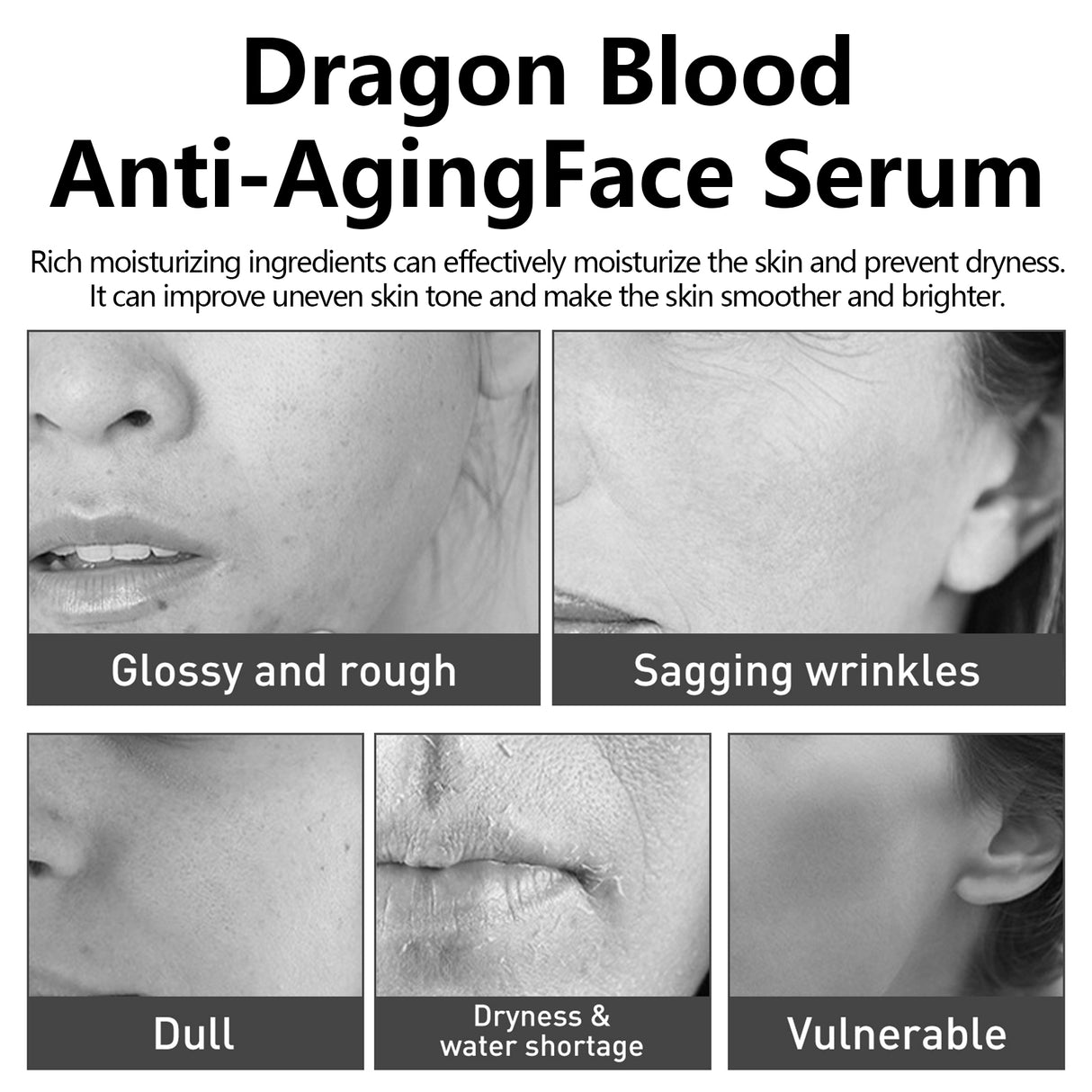 Dragon Blood Facial Treatment Essence Moisturizes And Tightens Soft, Smooth And Delicate Facial Skin - V.I.P Digital Presence