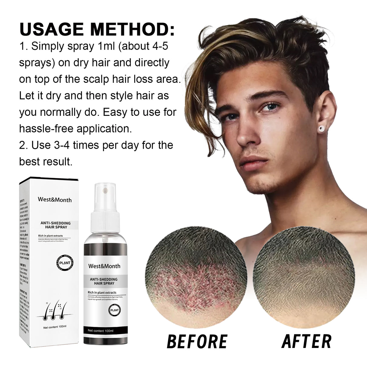 West & Month Anti-Shedding Hair Spray, Improve The Hairline Hair Hair Nutrition Moisture Hair Roots - V.I.P Digital Presence