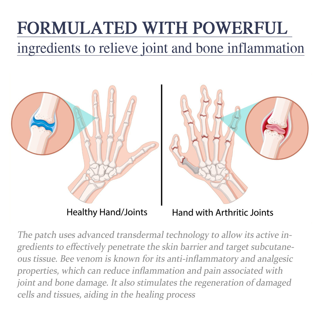 Bee Venom Joint Cream, Relieves Hands Legs Bones Knees Lumbar Spine Sedentary Joint Pain Body Care Cream - V.I.P Digital Presence