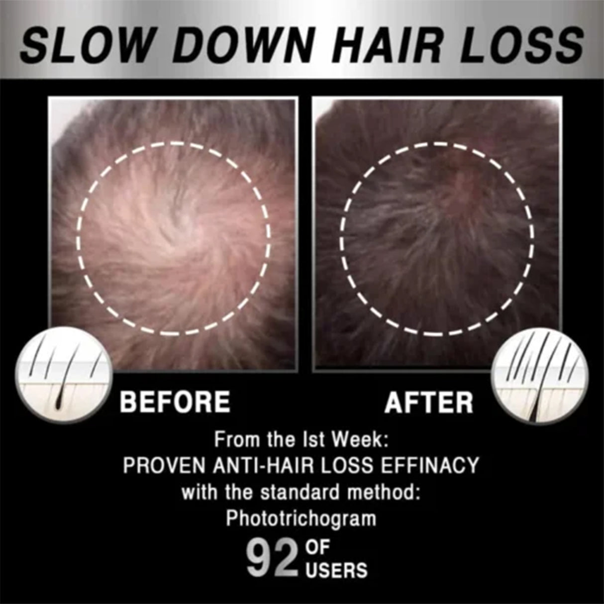 Moving Hair Growth Treatment, Repair Frizzy, Smooth And Dense Hair Scalp Care Heating Massage Cap - V.I.P Digital Presence