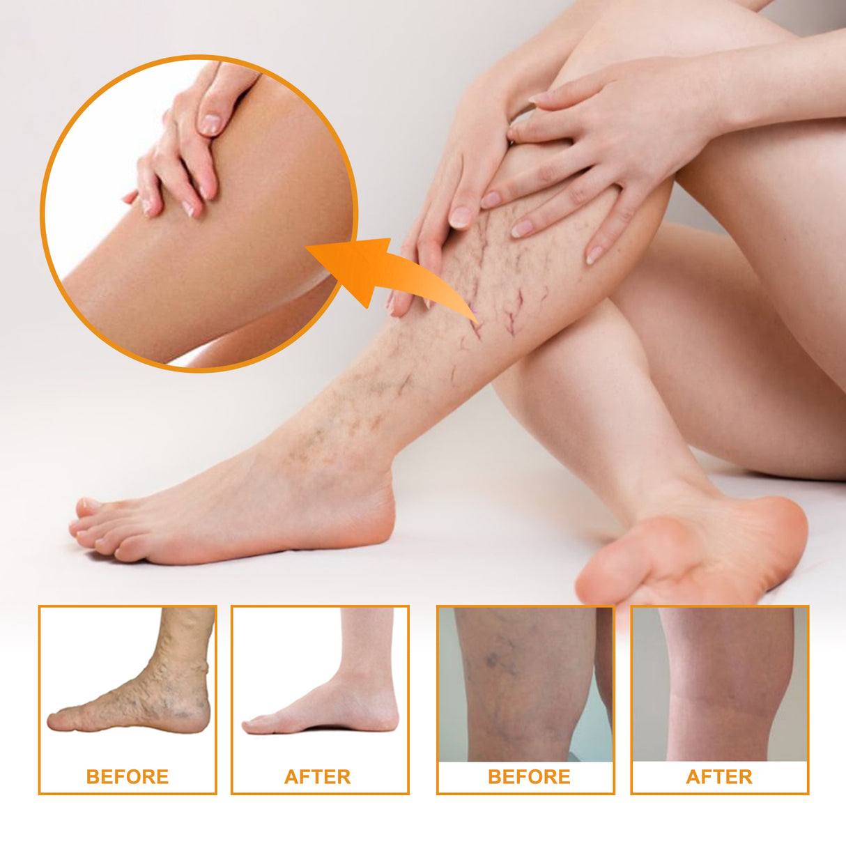 Vitamin K Cream Skin Care For Sore And Swollen Legs Earthworm Leg Vein Massage Cream - V.I.P Digital Presence