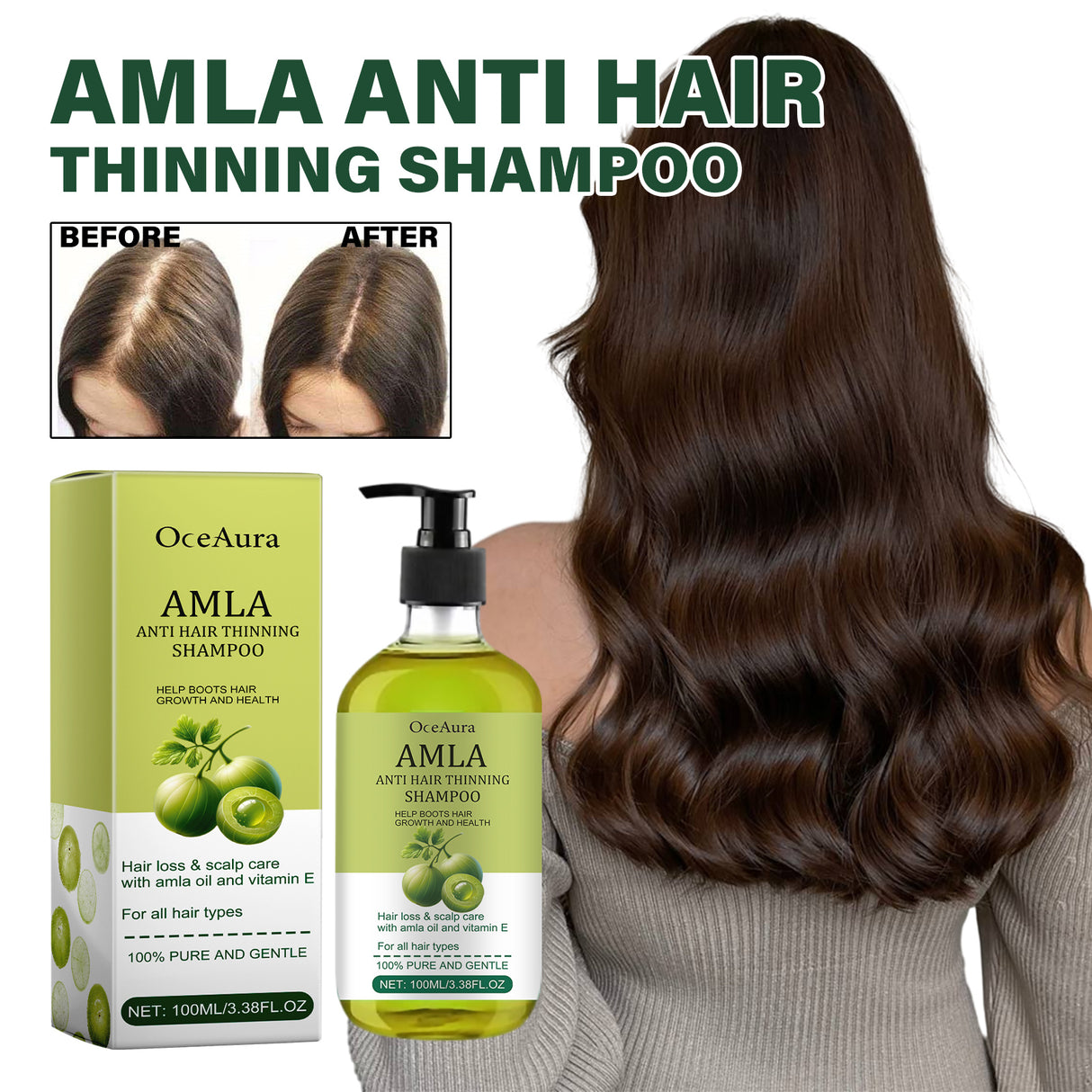 Amla Anti Hair Thinning Shampoo, Scalp Cleanness Moist Smooth Shiny Hair, Dense Hair Wash Protect Suits - V.I.P Digital Presence