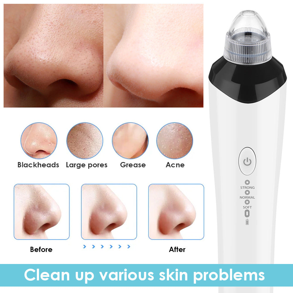High-Definition Visual Blackhead Meter Three-Speed Intelligent Vacuum Adsorption Pore Cleaner Wifi Timing - V.I.P Digital Presence