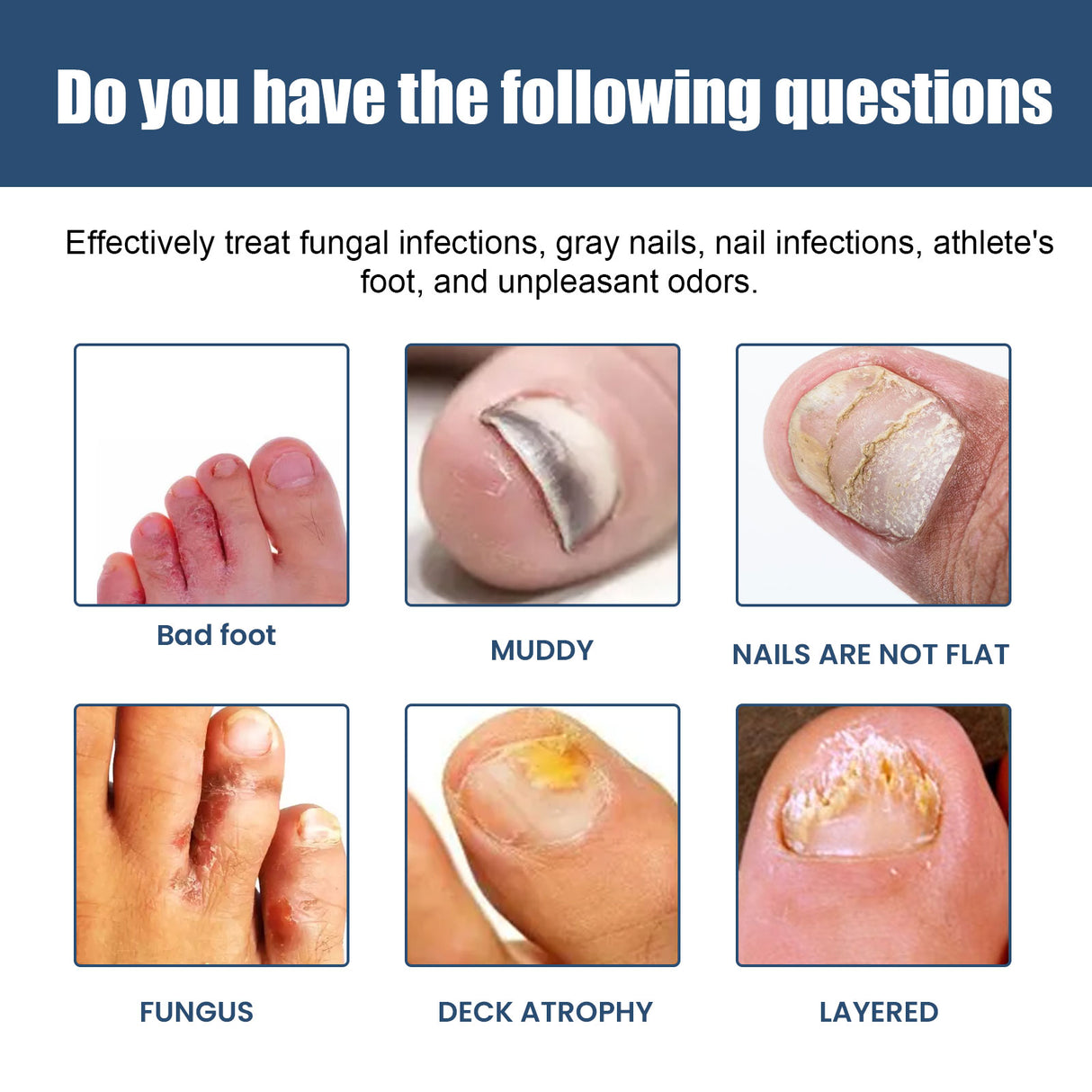 Nail Care Spray Gently Cleans Foot Nails Moisturizing And Brightening Nail Care Spray - V.I.P Digital Presence