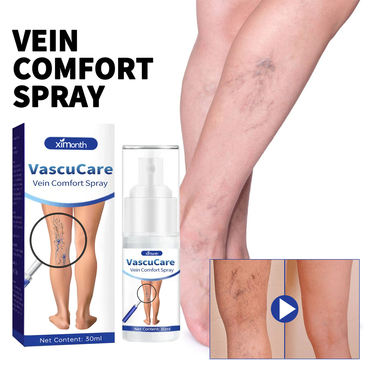 Vein Comfort Spray, Relief Leg Muscle Soreness And Swelling Earthworm Leg Vein Treatment Spray - V.I.P Digital Presence