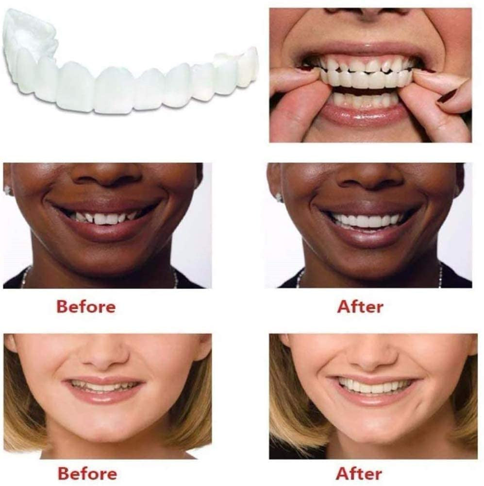 Upper Teeth And Lower Teeth Simulation Braces Non-Porous Braces Whitening Sleeves Second-Generation Silicone Simulation Teeth Dentures - V.I.P Digital Presence