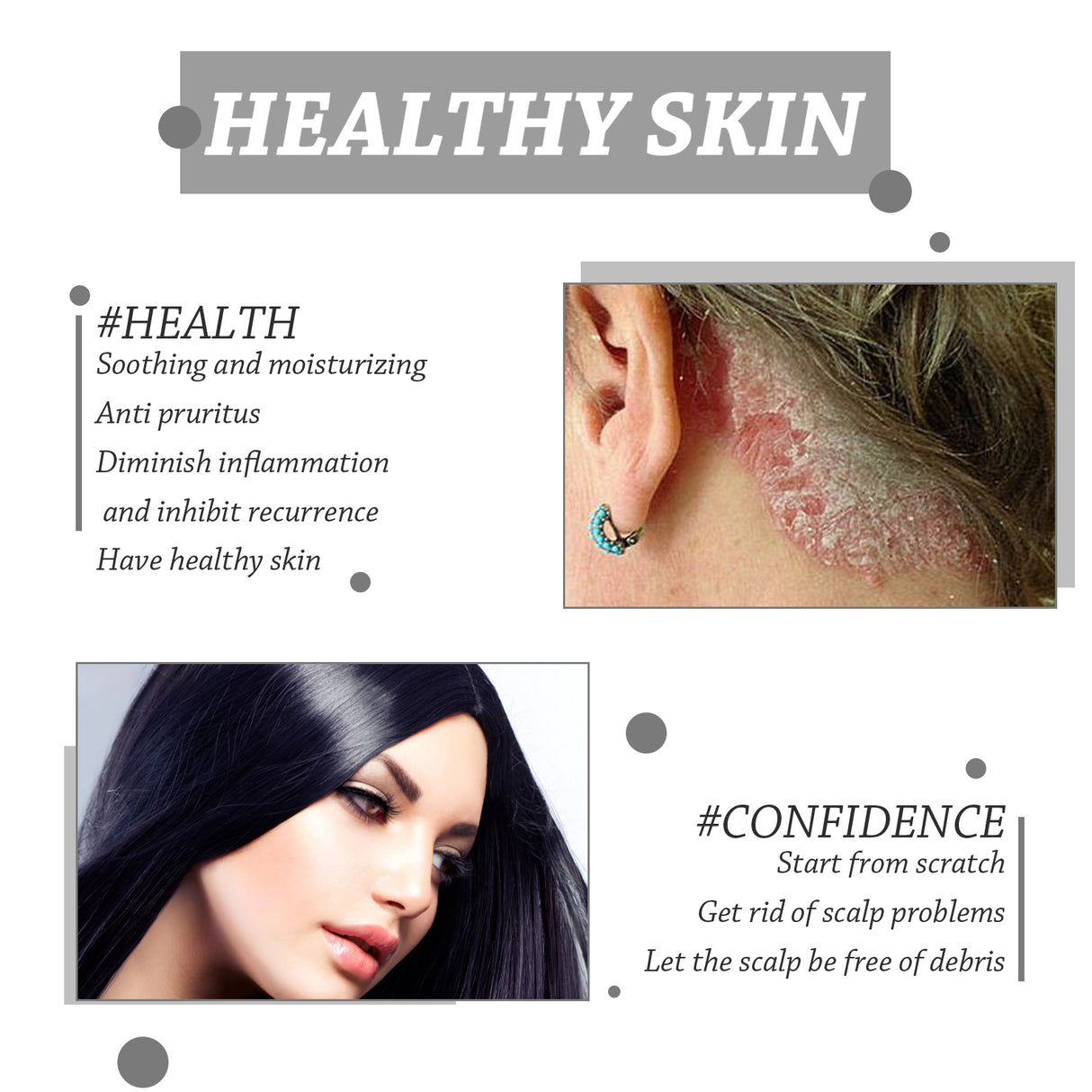 Scalp Care Ball, Repair Skin Moss Scalp Moss Deep Clean And Moisturizing Scalp Care Ball - V.I.P Digital Presence