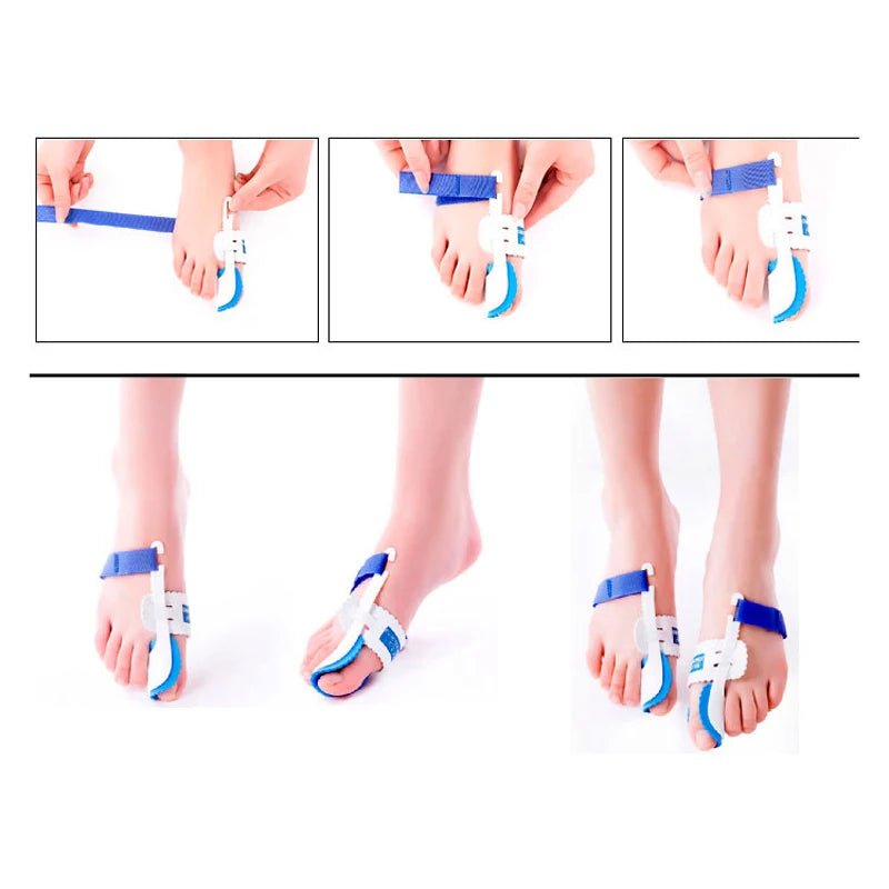 Bunion Device Hallux Valgus Orthopedic Braces Toe Correction Night Foot Corrector Thumb Goodnight Daily Big Bone Orthotics - V.I.P Digital Presence