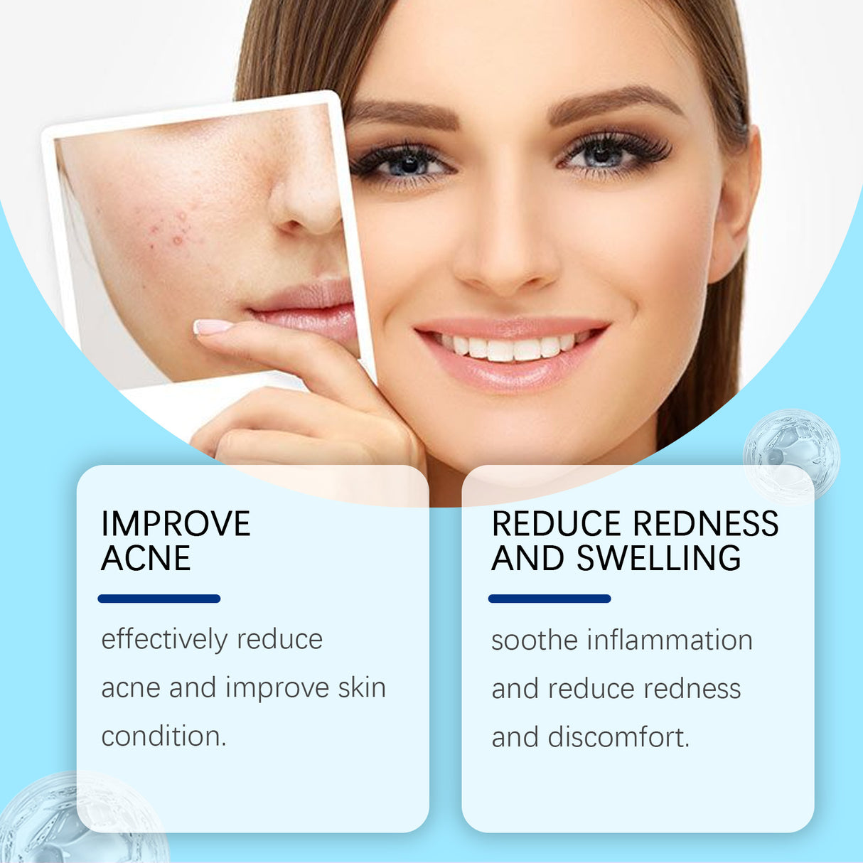 Retinol Gel Gently Cleanses Face Acne Care And Improves Skin Gel - V.I.P Digital Presence