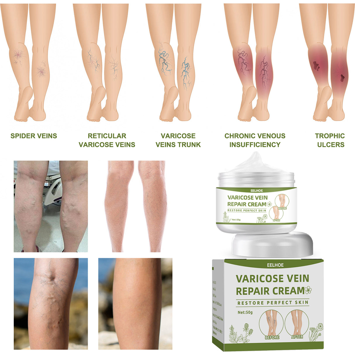 Leg Repair Cream Relieves Leg Discomfort Massage Leg Repair Cream For Raised Veins - V.I.P Digital Presence