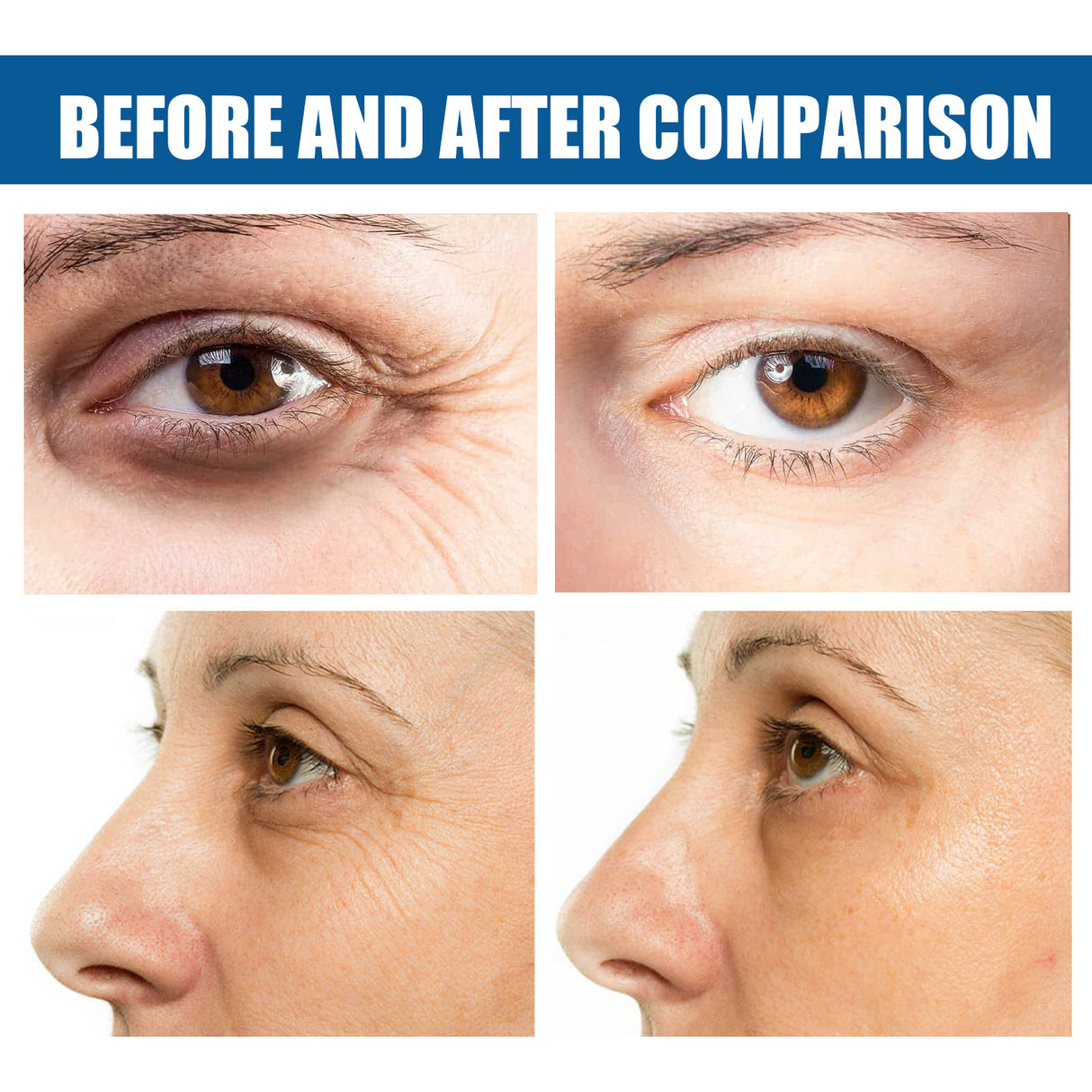 Collagen Eye Mask Removes Fine Lines And Dark Circles Hydrating And Firming Lift Crystal Eye Mask - V.I.P Digital Presence