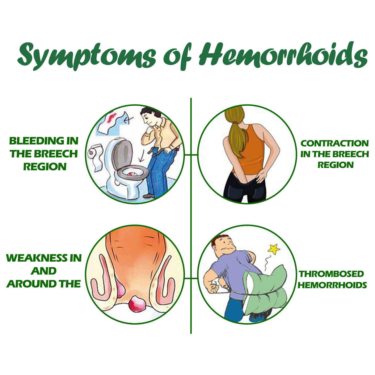 Hemorrhoids Spray, Relieve Swelling And Hemorrhoid Pain External Treatment For Broken Sore Anal Soothing Spray - V.I.P Digital Presence