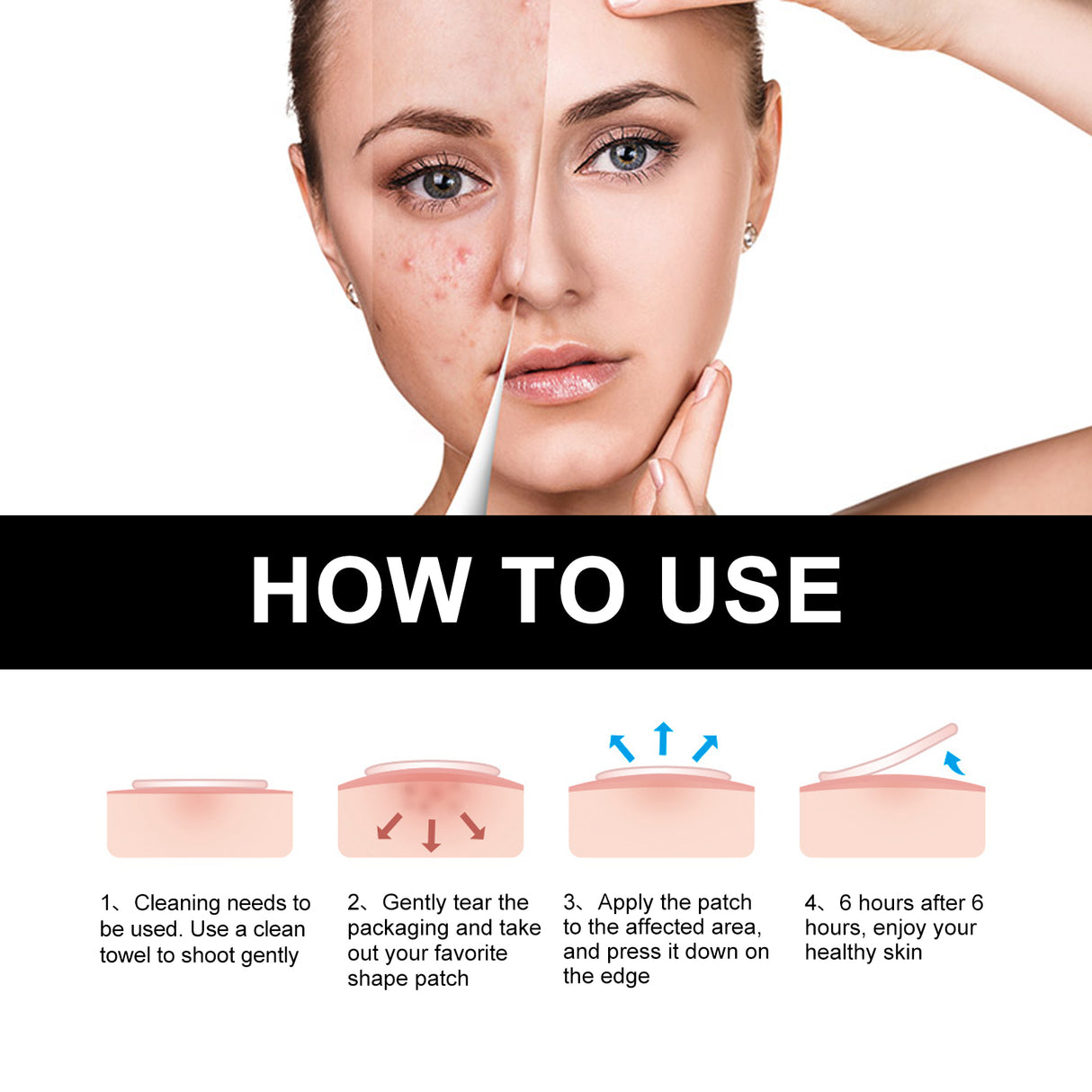 JAYSUING Cute Black Acne Patch, Facial Acne Lightening Repair Acne Closing Acne Mark Blackhead Removal