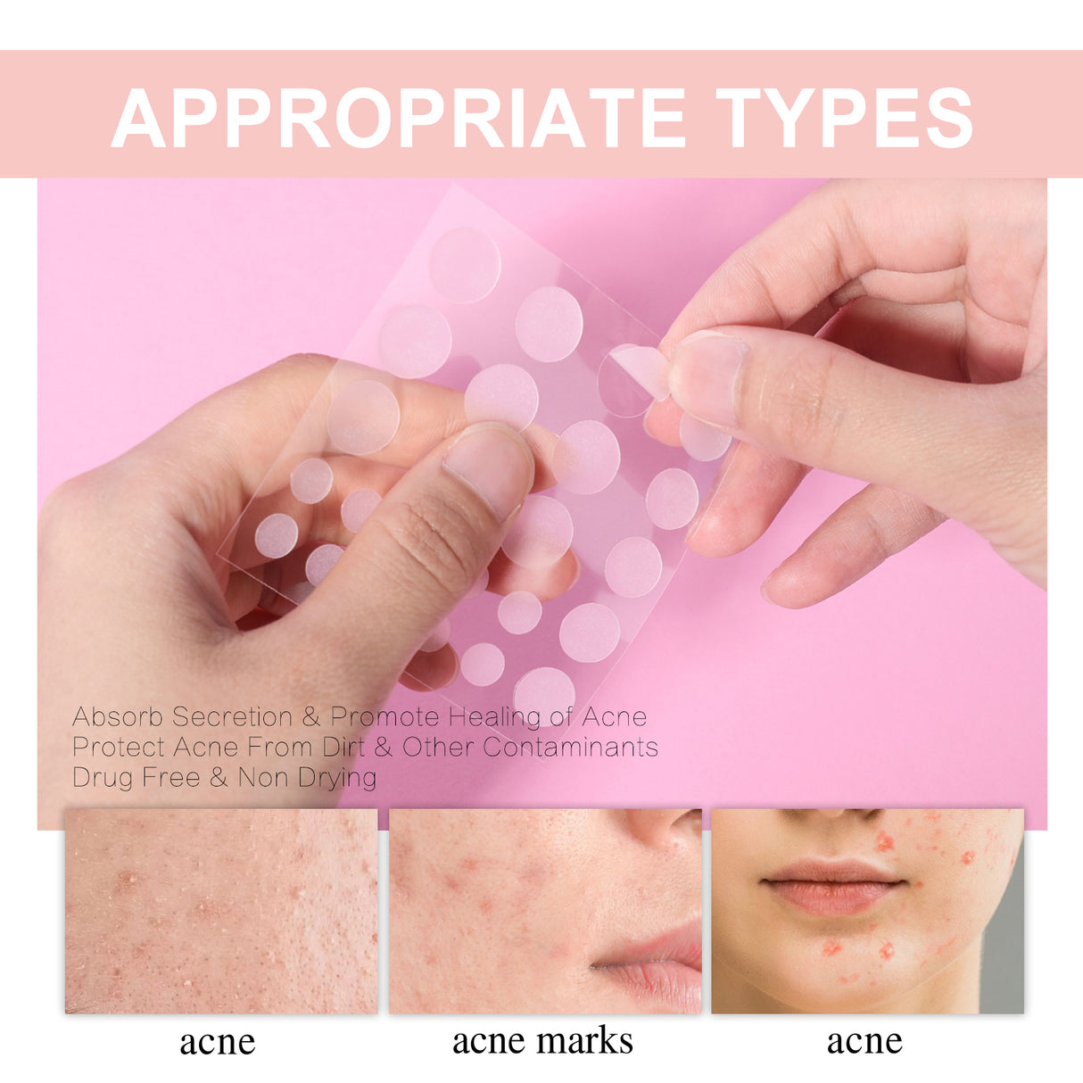 Acne Patch, Repair Acne Pimples Acne Invisible Concealer Breathable Acne Patch - V.I.P Digital Presence