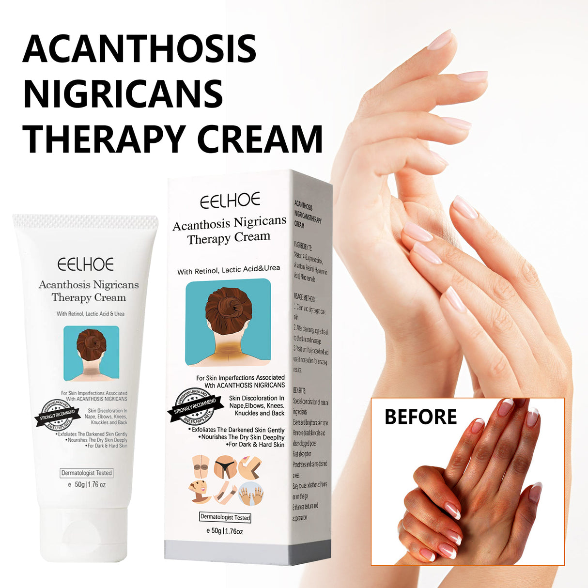 Black Acanthoderm Repair Cream Repair Underarm Arm Knee Joint Black Moisturizing Whitening Body Care Cream - V.I.P Digital Presence