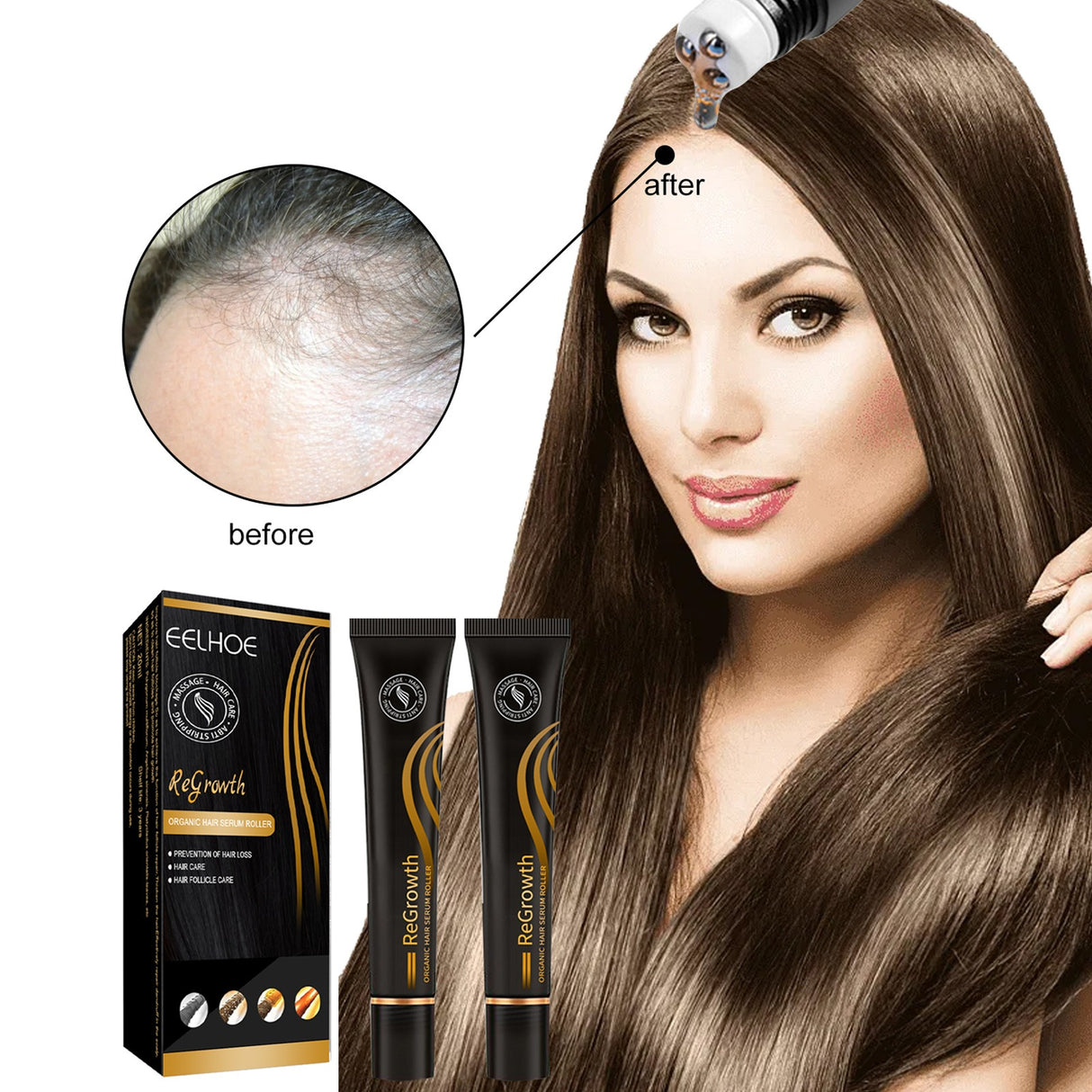 EELHOE Ball Bearing Dense Hair Essential Oil Thick Sparse Hair Bead Massage Scalp Care Fluid To Prevent The Loss Of Essential Oil - V.I.P Digital Presence