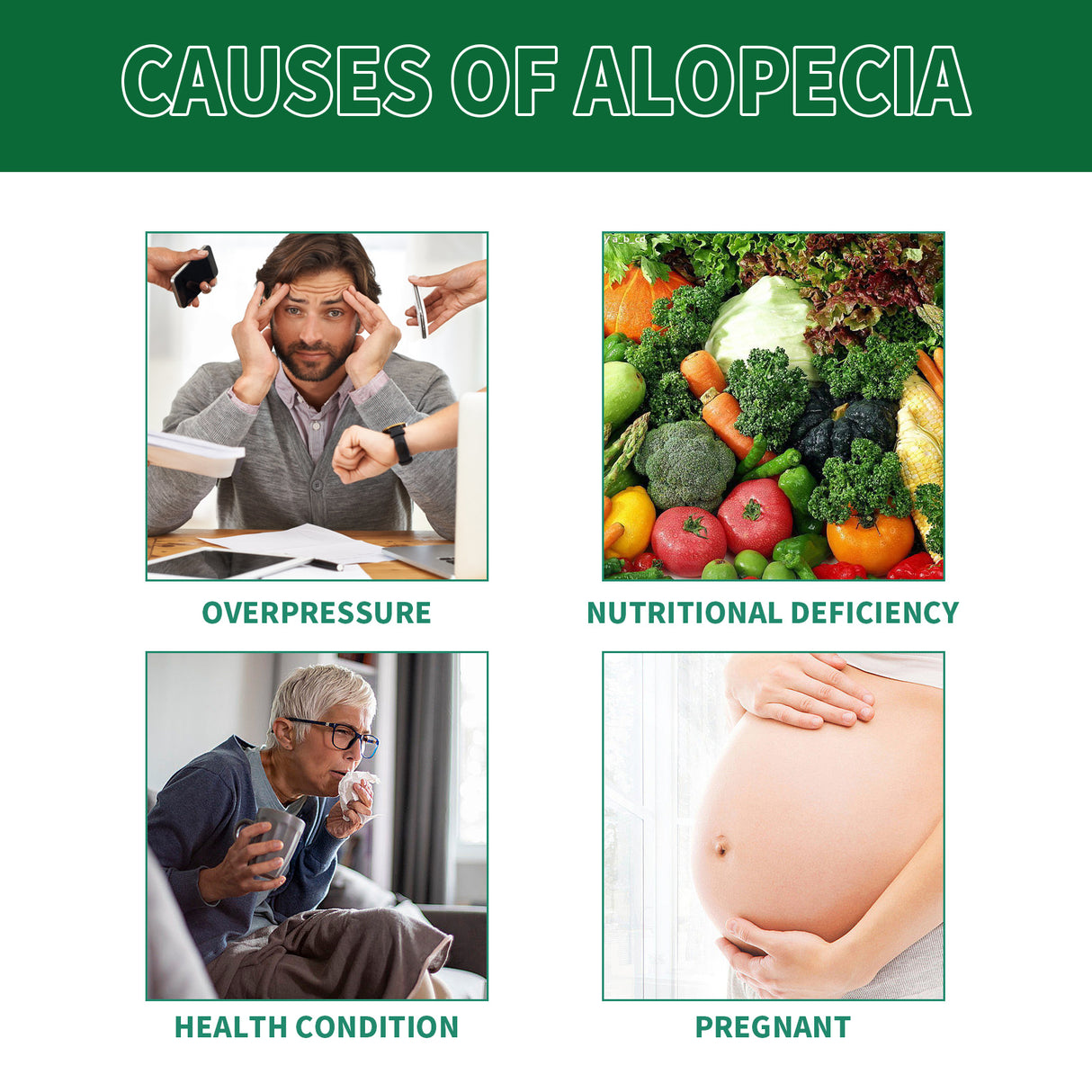 Hair Growth Spray, Thickening Preventing Loss And Repairing Hair Follicle Damage Dry And Frizzy Hair Spray - V.I.P Digital Presence