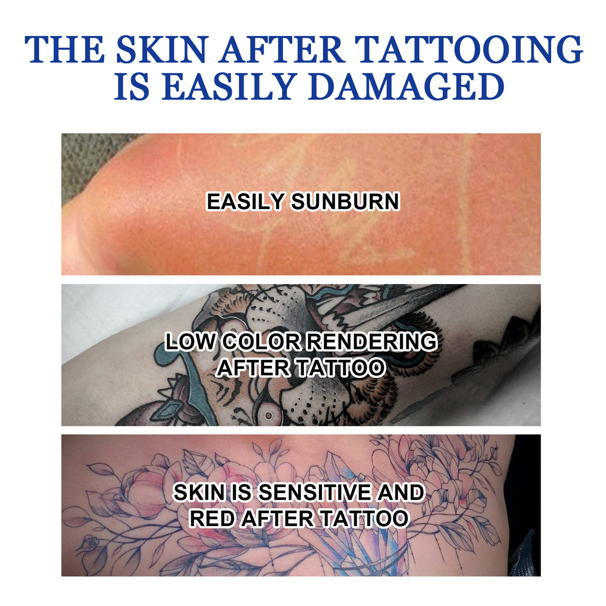 Tattoo Dissolving Gel, Moisturizing Tattoo Skin Repair Skin Tattoo Mark Brightening Care Cream - V.I.P Digital Presence