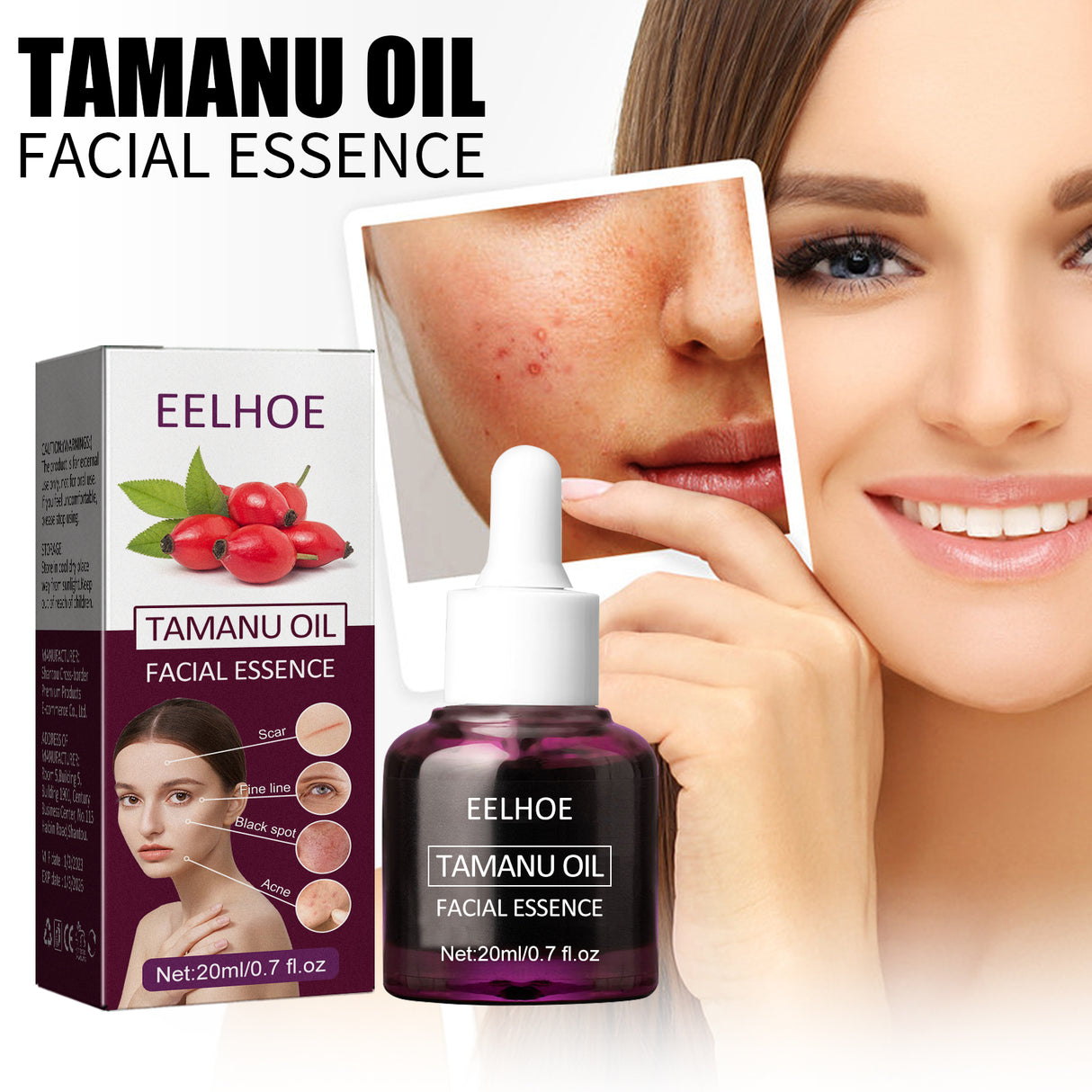 Tamanu Facial Oil, Relieves Acne Marks Fine Lines Moisturizes and Firms Skin Essential Oil - V.I.P Digital Presence