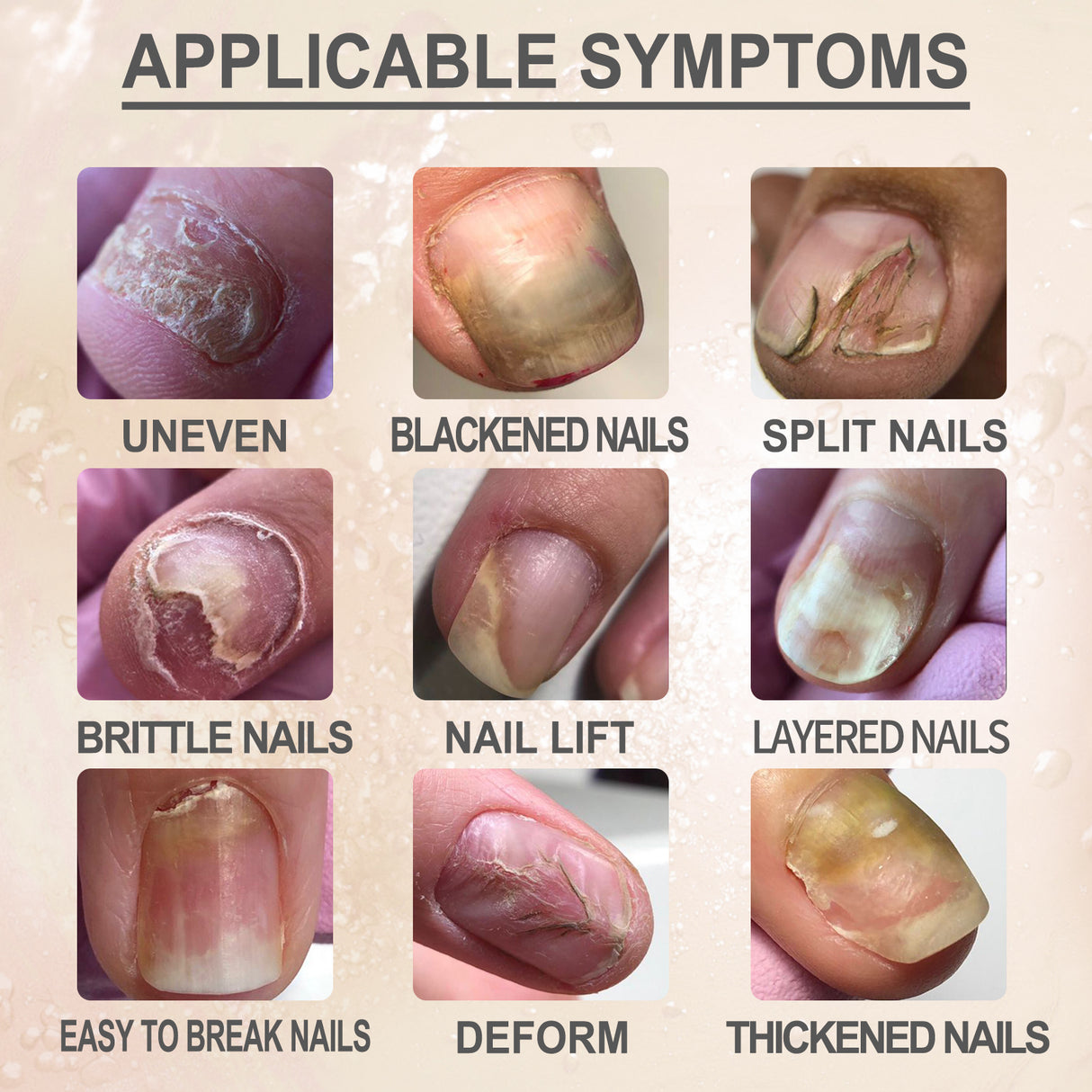 7 Day Nail Repair Essence, Hand And Foot Gray Nail Brightening Soft Nail Thickening Toenail Care Solution - V.I.P Digital Presence