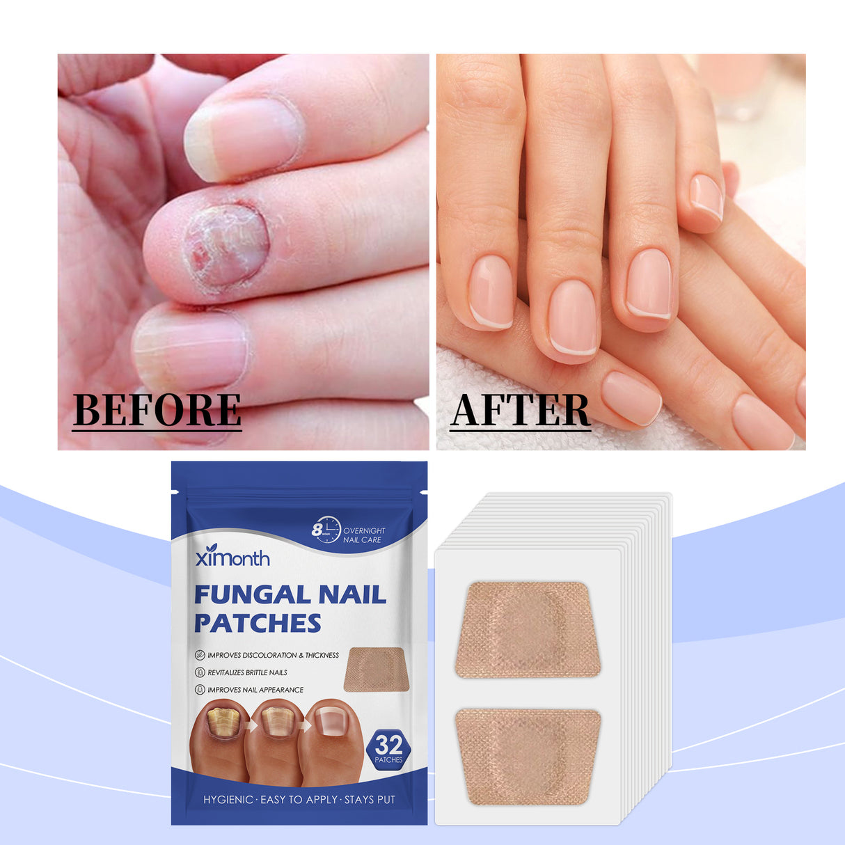 Nail Care Patches Gently Repair Nails For Easy Daily Cleaning With Simple Care Patches - V.I.P Digital Presence