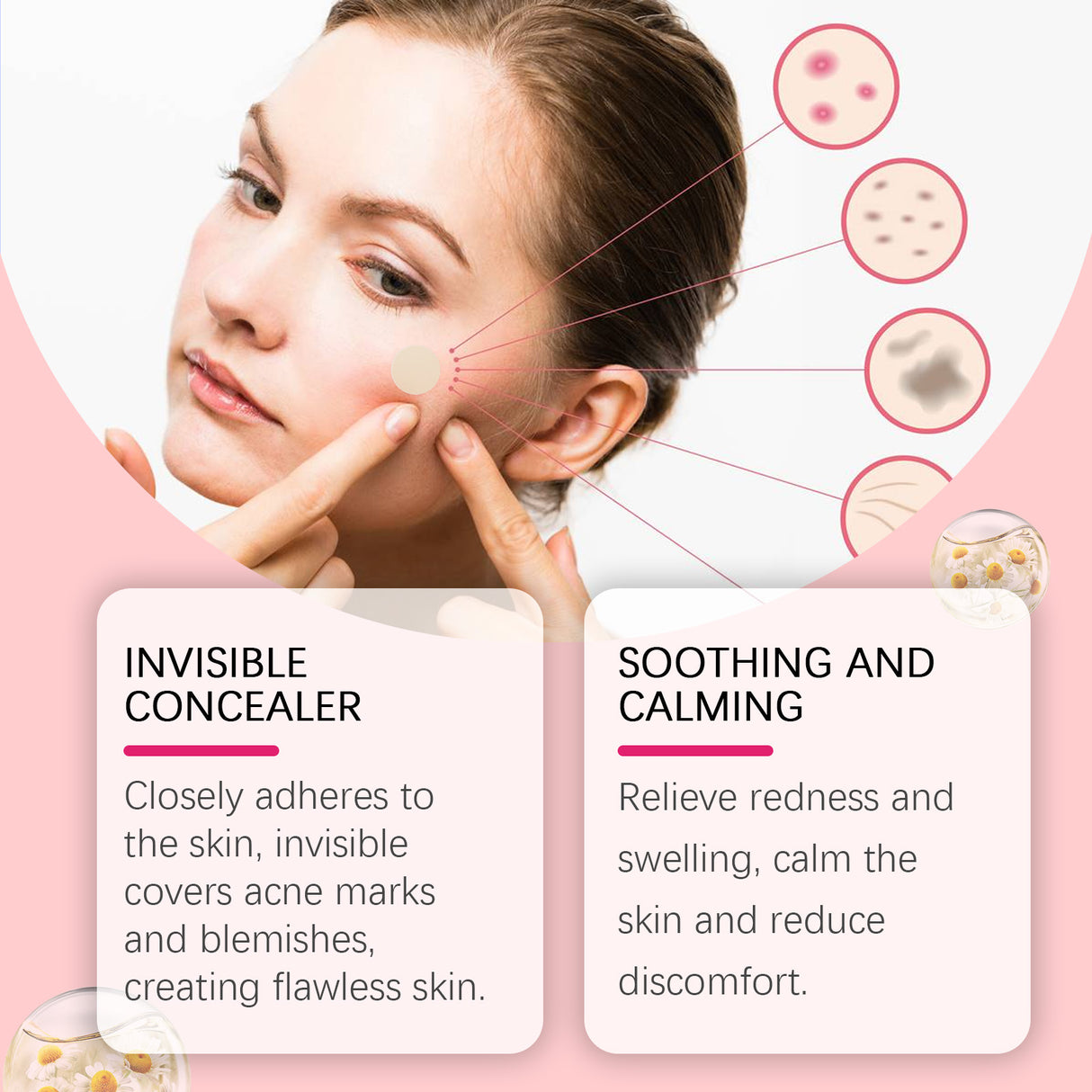 Repair Acne Patch, Facial Cleansing Cover Acne Skin Moisturizing Gentle Skin Cream - V.I.P Digital Presence