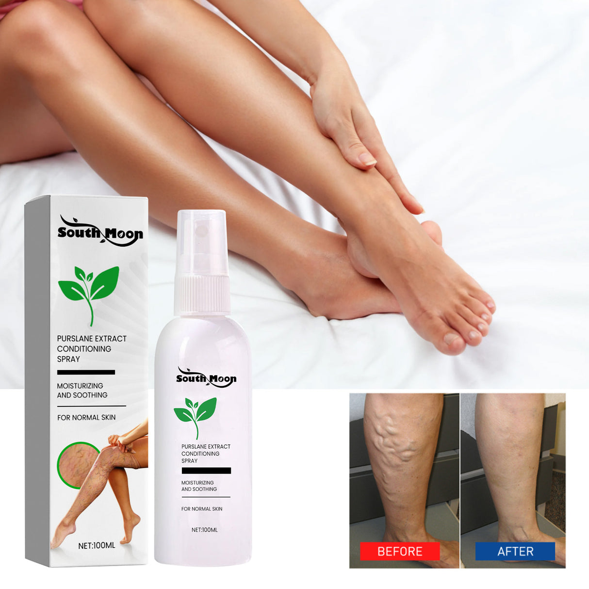 Purslane Extract Conditioning Spray, Repair Earthworm Leg Relieve Leg Soreness Vein Massage Care Spray - V.I.P Digital Presence