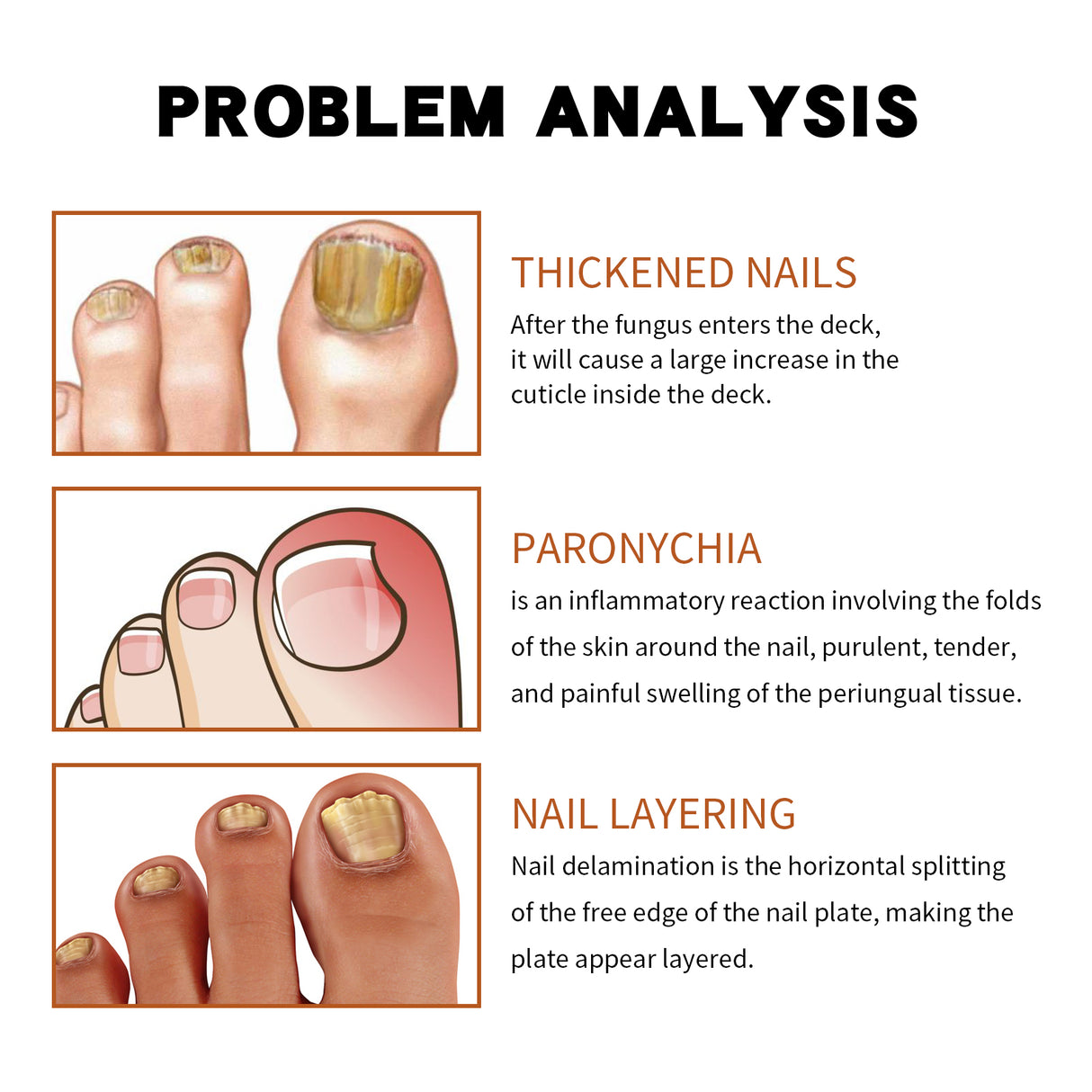 Anti-Nail Groove Relief Oil, Repair Inlaid Nails Gray Nails And Soft Thickening Nail Brightening Nails Care Oil - V.I.P Digital Presence