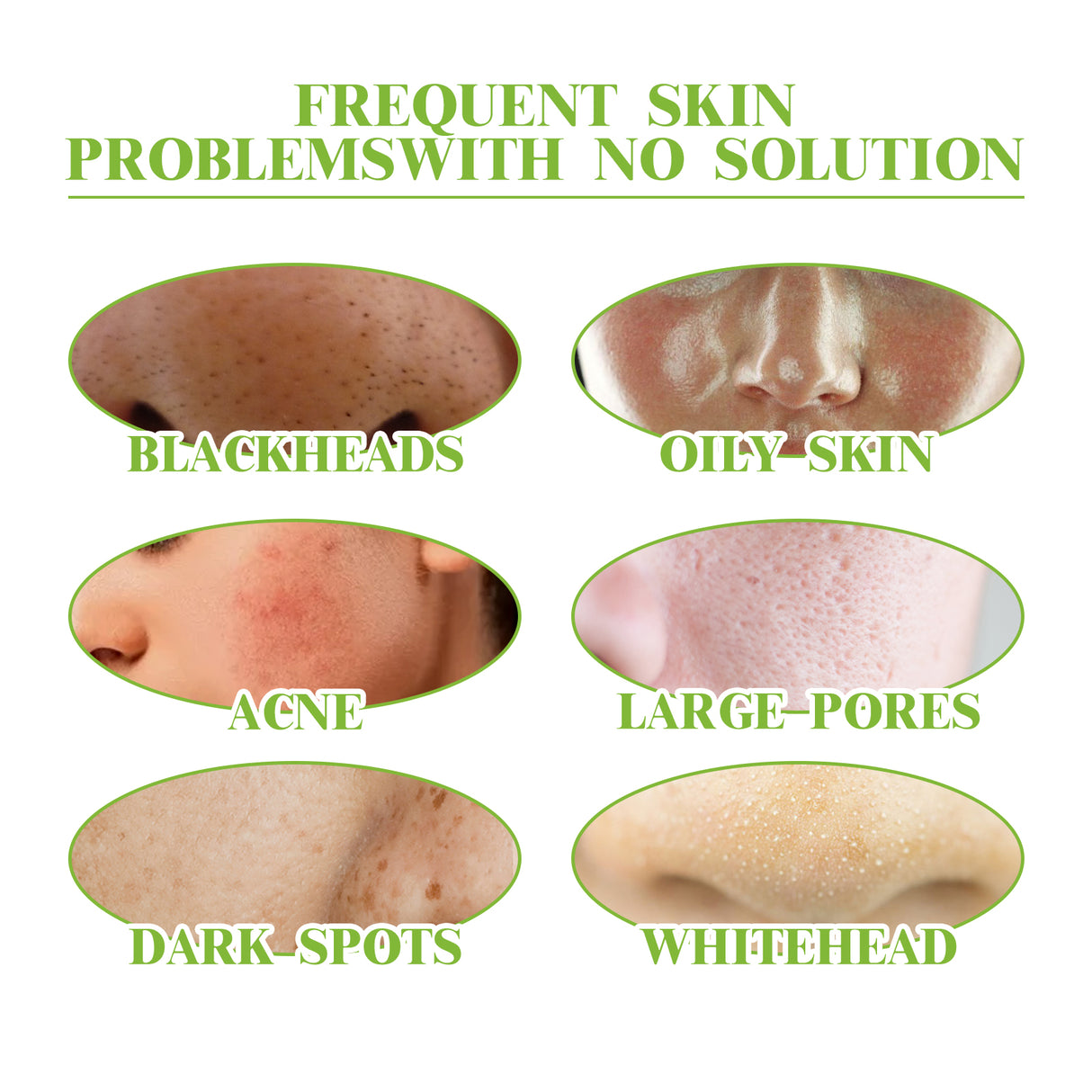 Green Tea Cleansing Mousse, A Deep Cleansing Facial Cleanser With Refreshing Oil Control And Wrinkles Reduction - V.I.P Digital Presence